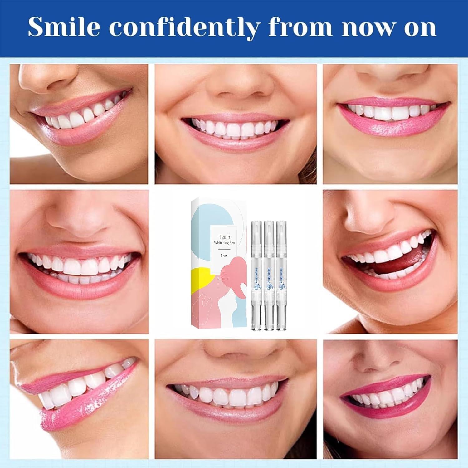 Bolígrafo Blanqueador de Dientes Gpoizmo - Gel Profesional