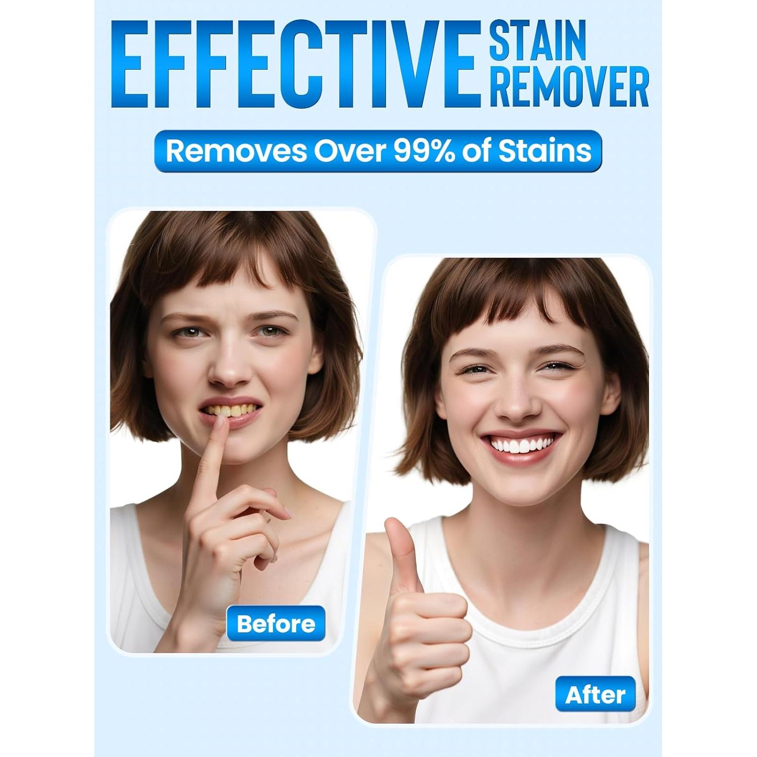 Kit Blanqueamiento Dental Nicwell para Dientes Sensibles - 3 Gel 35% y Luz LED