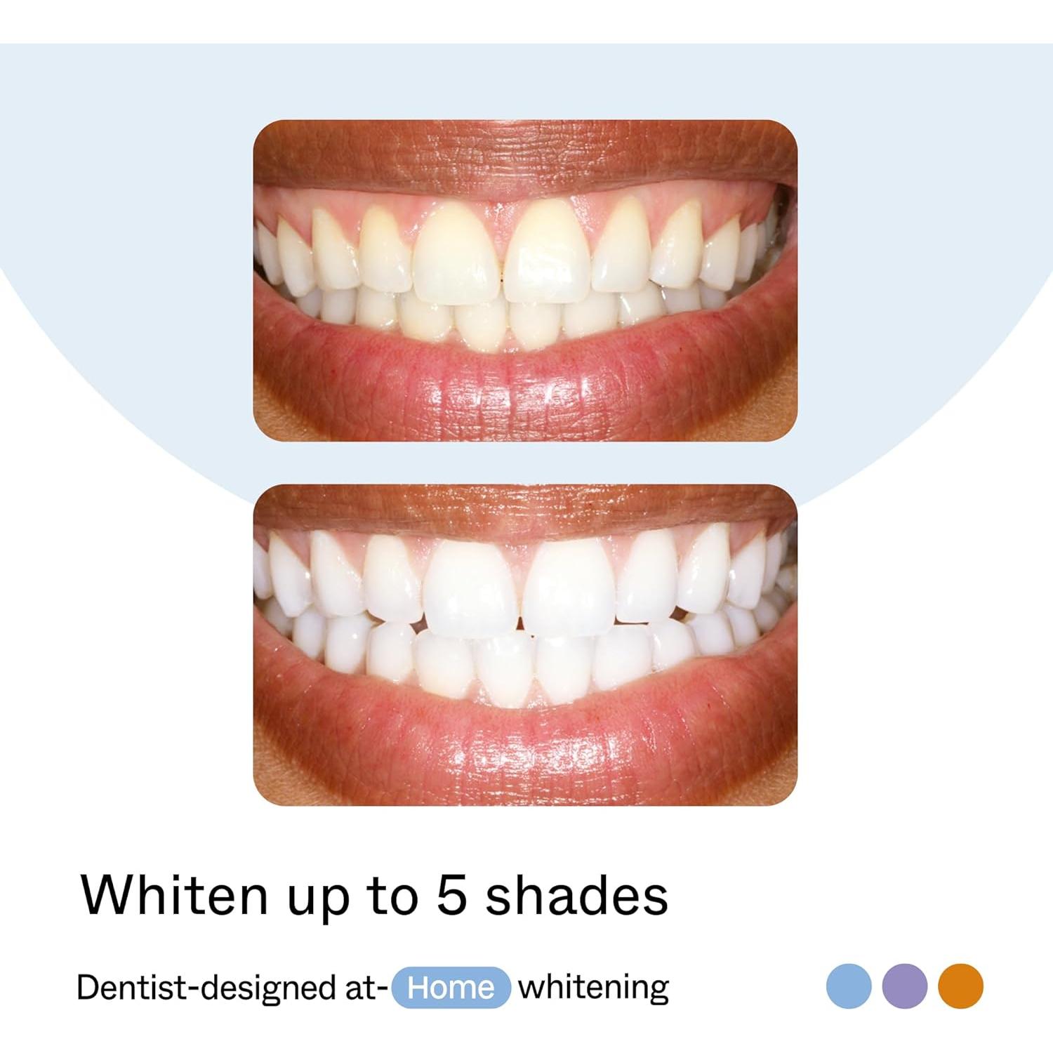 Kit de Blanqueamiento Dental Opalescence Home Advance 15% - 10 Tratamientos