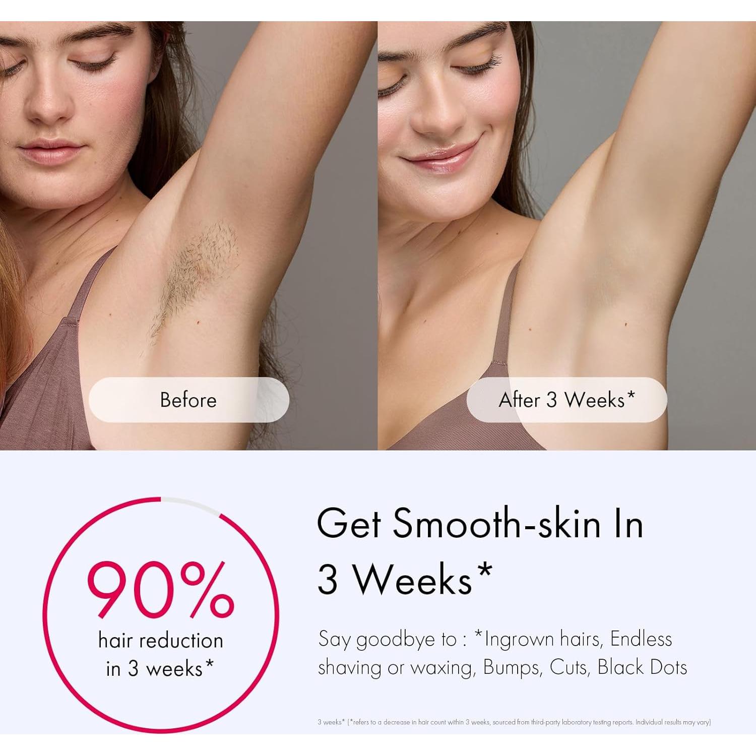 Depiladora IPL Ulike Air 3 con Enfriamiento, Casi Indolora