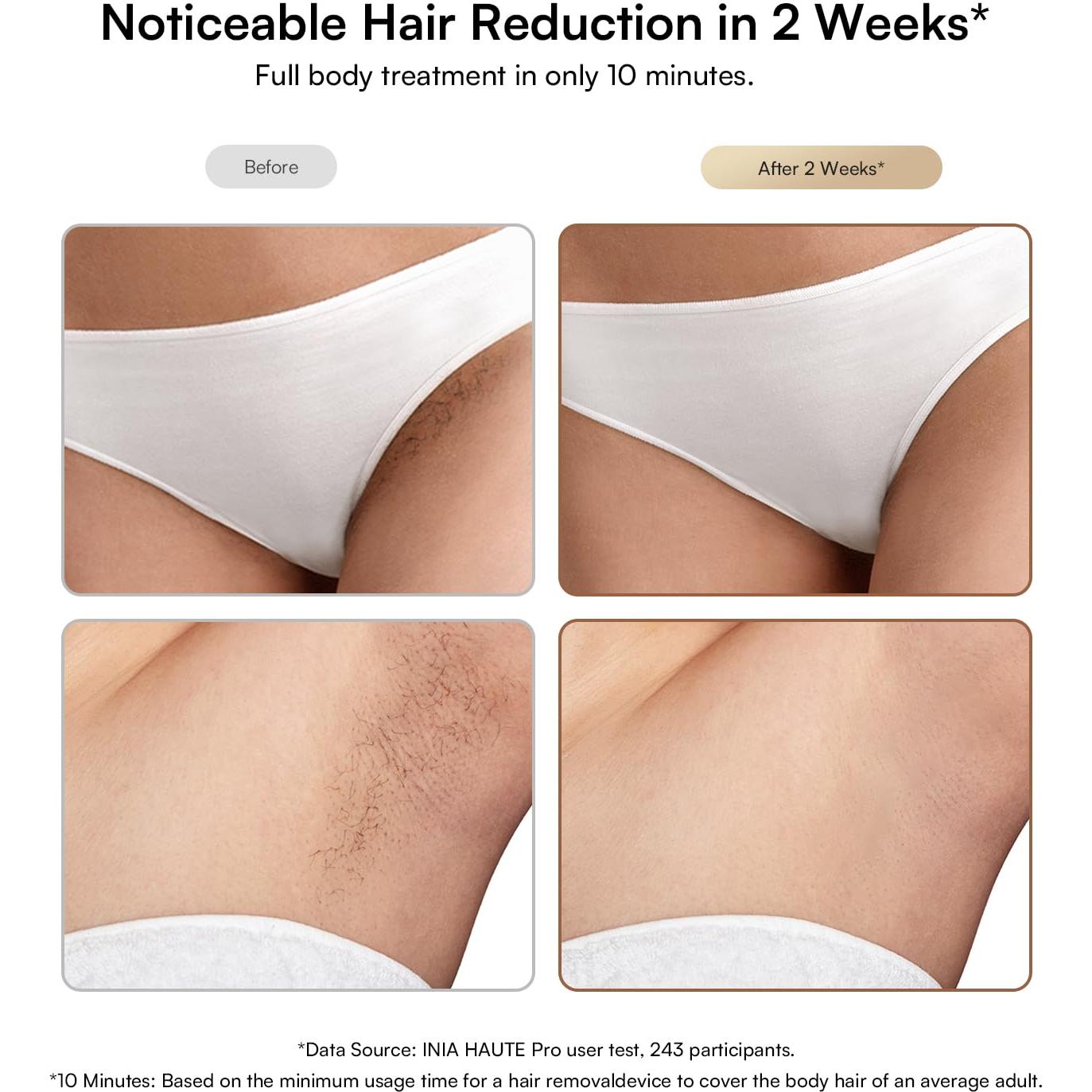 Eliminador de Vello IPL INIA HAUTE Pro Rosa Fucsia Indoloro