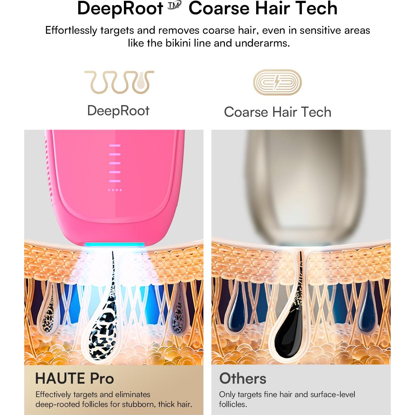 Eliminador de Vello IPL INIA HAUTE Pro Rosa Fucsia Indoloro