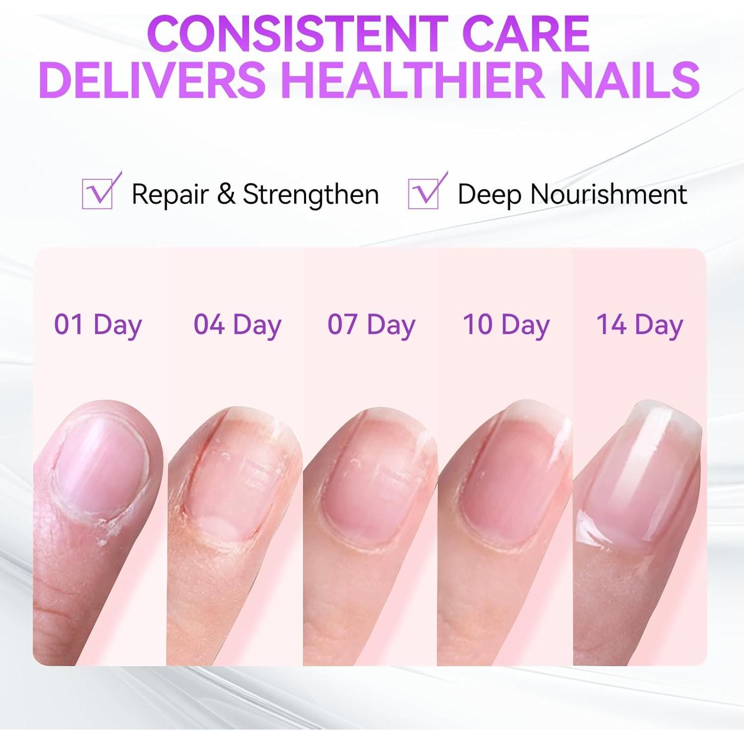 Kit de Tratamiento para Uñas Gelike - Endurecedor y Deshidratador