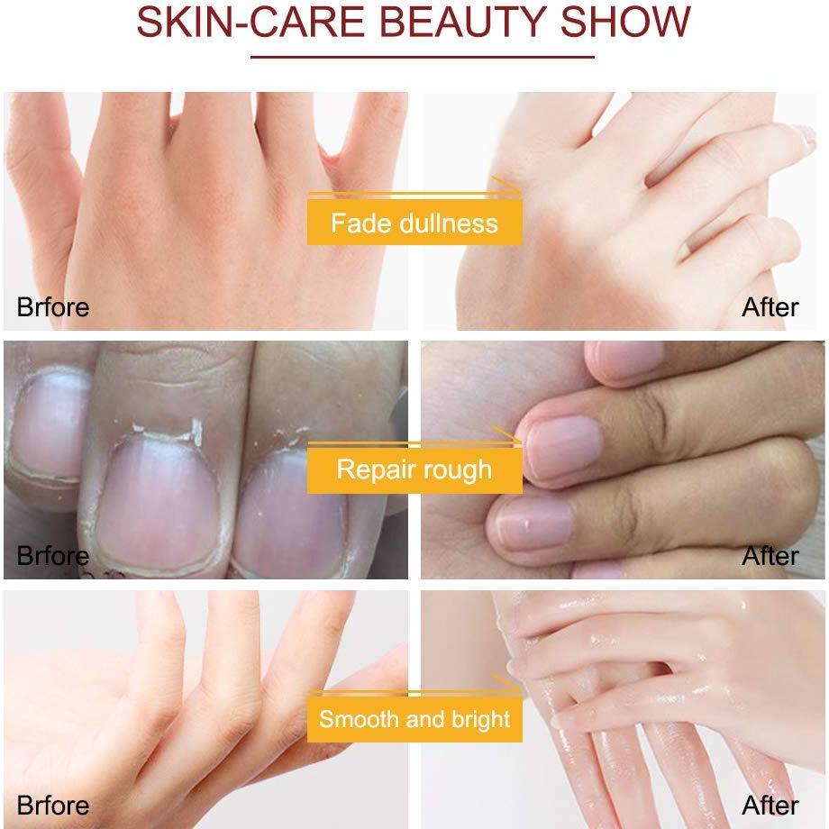 Mascarilla Hidratante para Manos USJBF - 5 Pares Guantes Reparadores