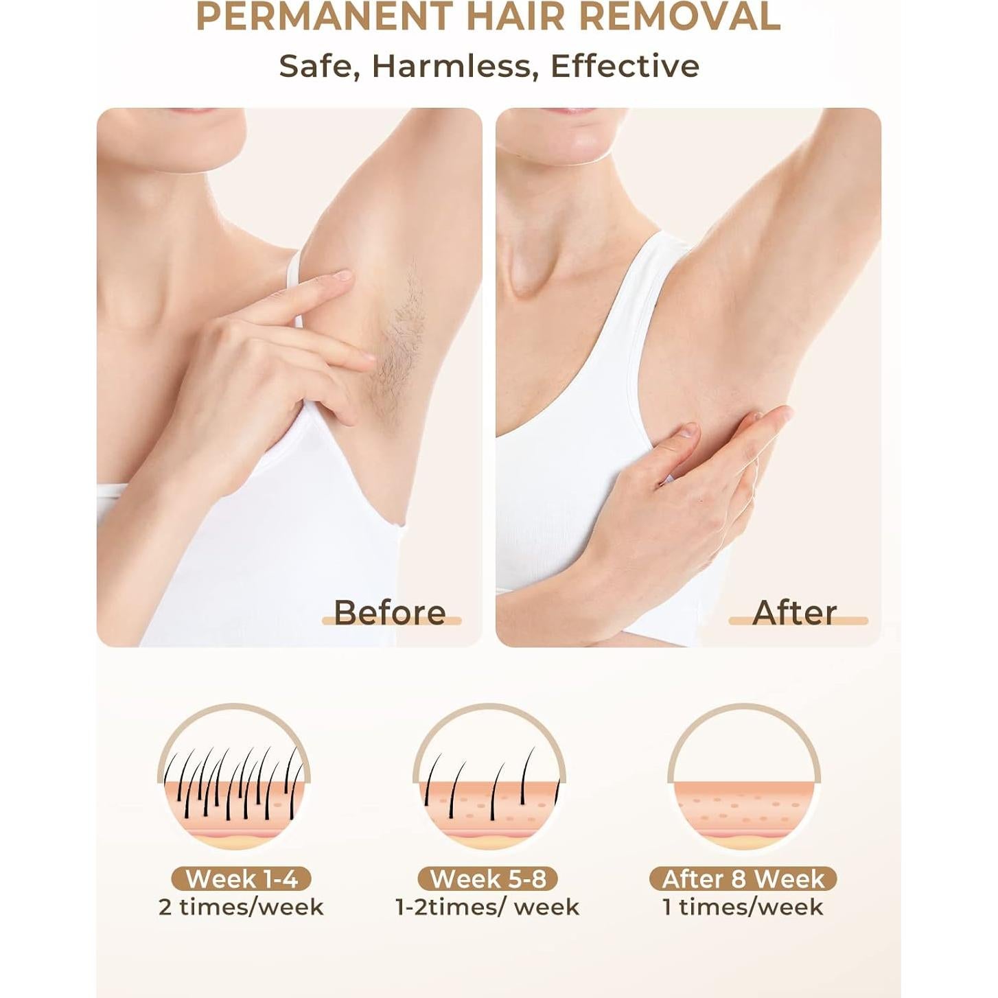 Depiladora Láser IPL LYSMOSKI para Uso Facial y Corporal