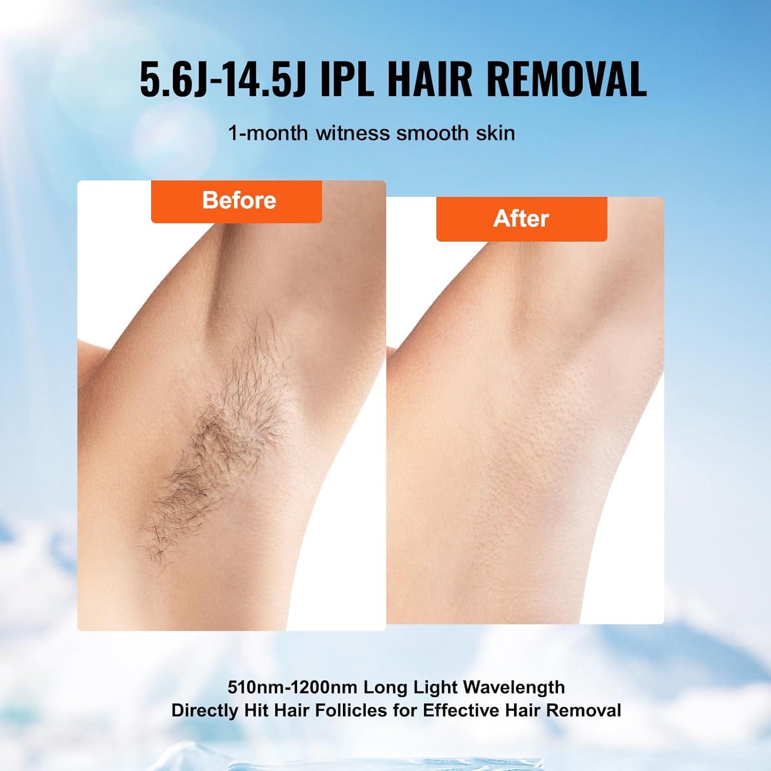 Sistema IPL VEVOR para Eliminación de Vello Indoloro en Casa