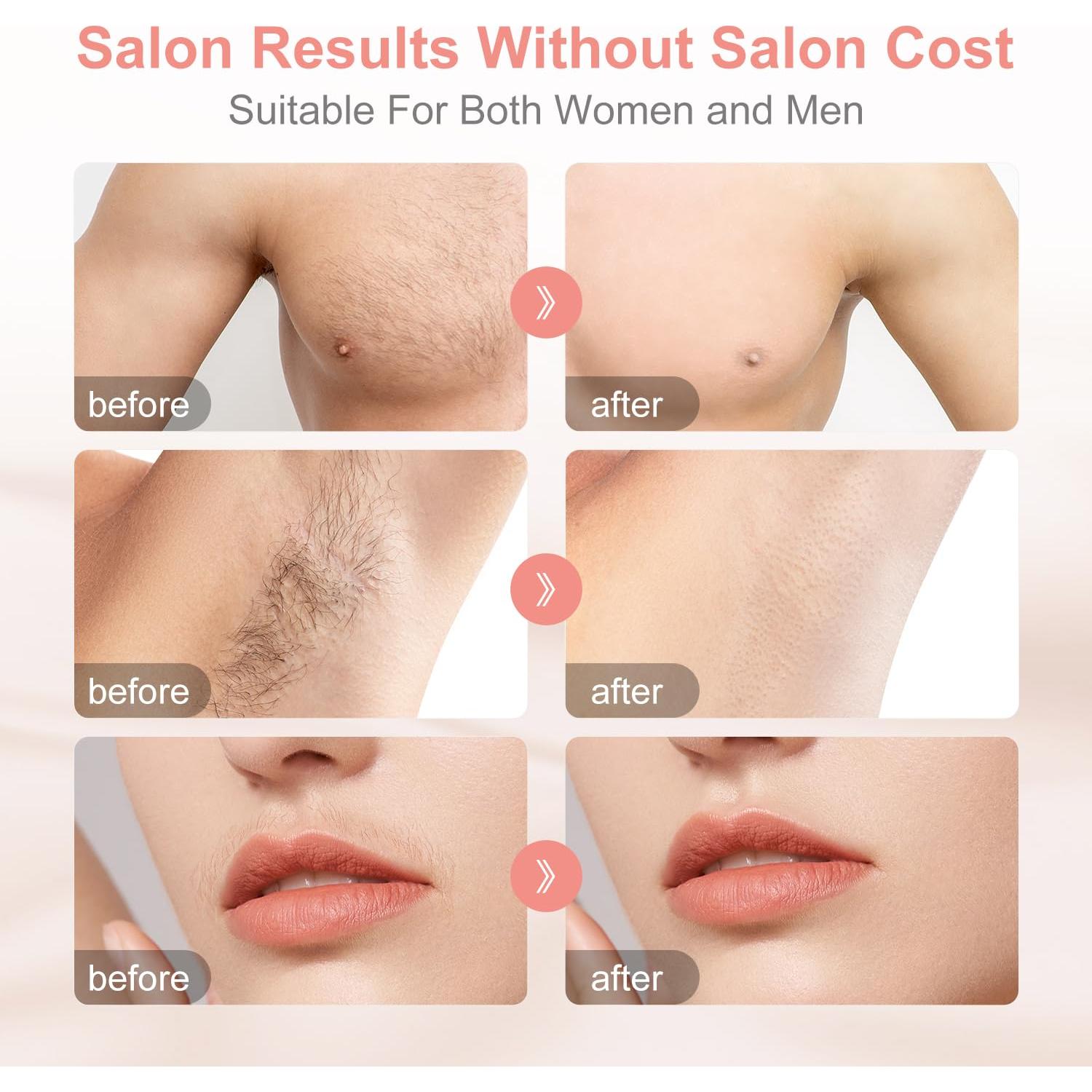 Aphrona Eliminador de Vello IPL | Seguro y Efectivo | 500,000 Destellos