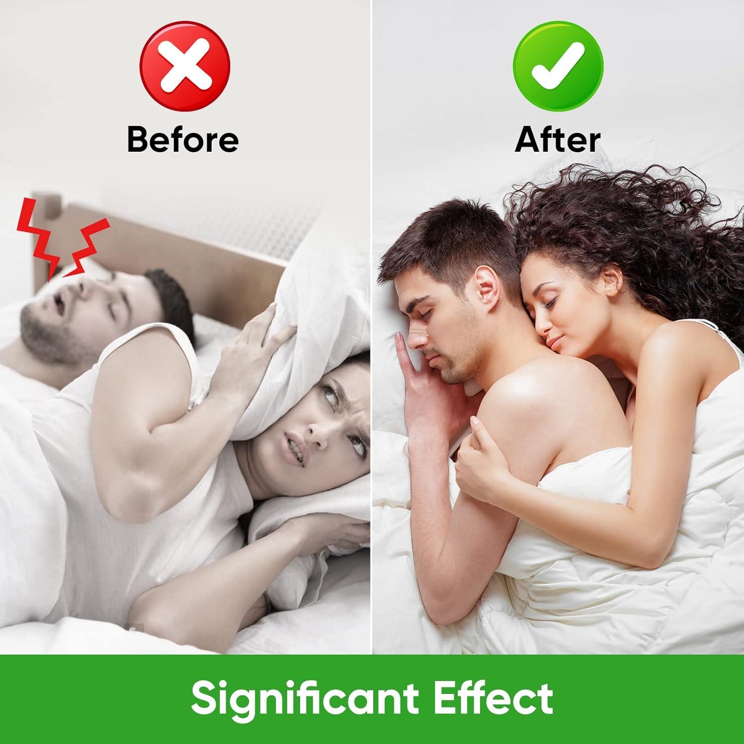 Tiras Nasales Anti Ronquidos TOMENGBEIAABBCC - 100 Pcs