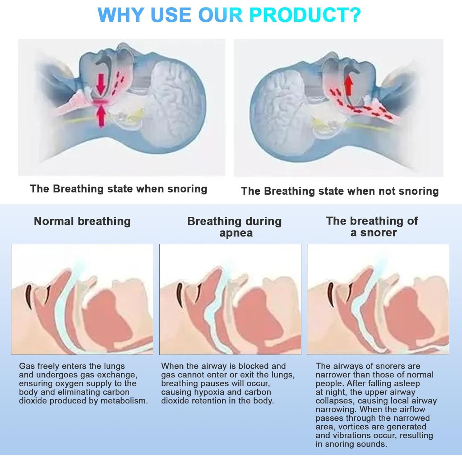 Dispositivo Antirronquidos Simon & Brown - Efectivo y Cómodo