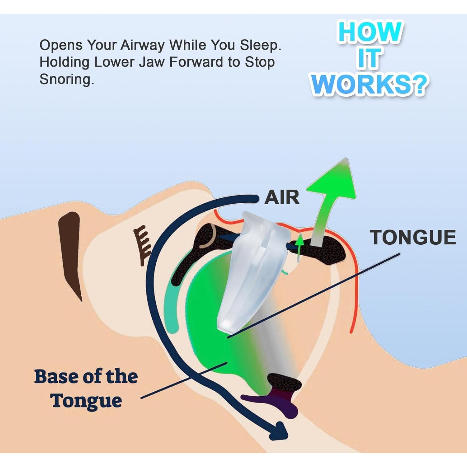 Dispositivo Antirronquidos Simon & Brown - Efectivo y Cómodo