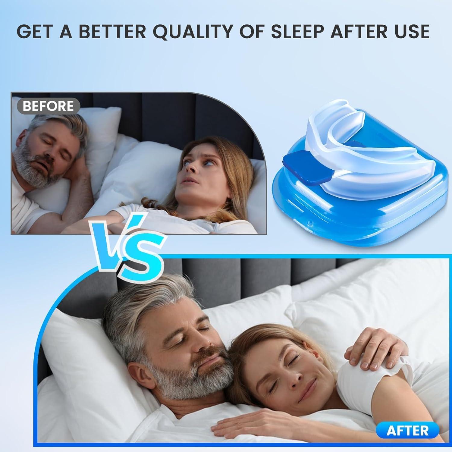 Dispositivo Antirronquidos HOYIGO Fácil de Usar 11.18x1.52x17.53cm