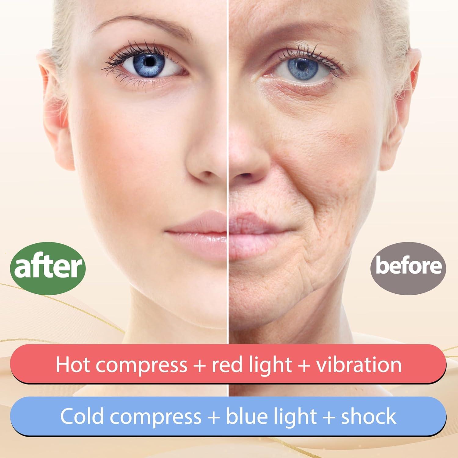 Masajeador Facial 7 en 1 ZoGoo - Calor y Frío LED para Piel