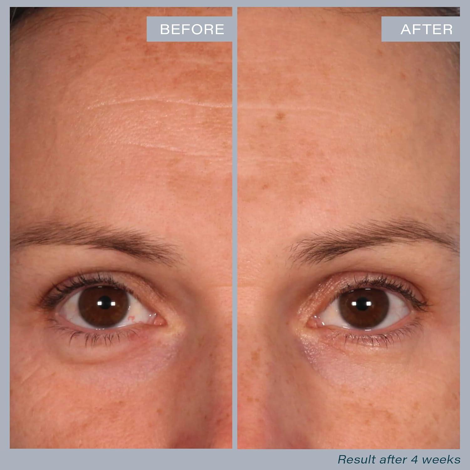 Almohadillas Exfoliantes Multi-Ácido SKINN - 60 Unidades