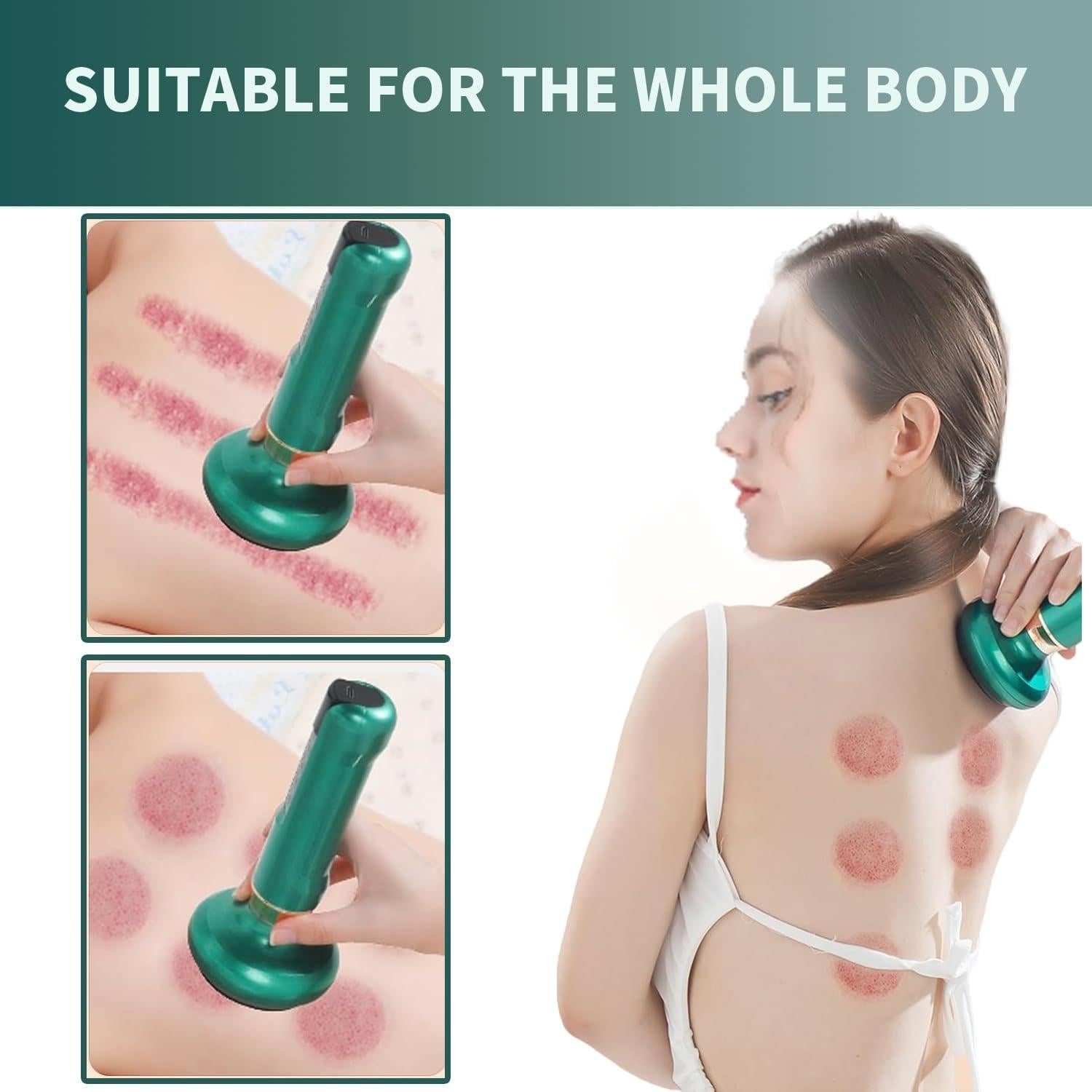 Masajeador de Celulitis Elouris Recargable 12 Niveles