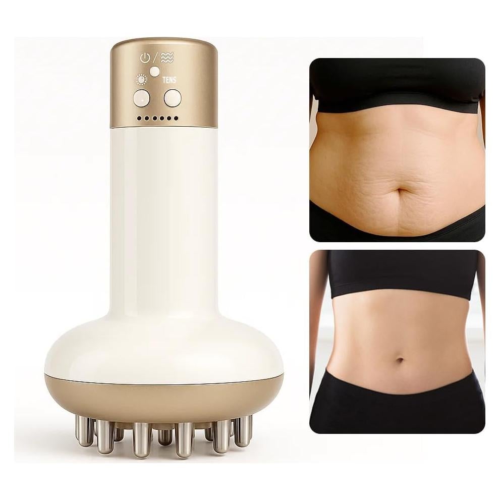 Masajeador Drenaje Linfático Yuonry L1, Anticelulitis, 9.5x9.5 cm