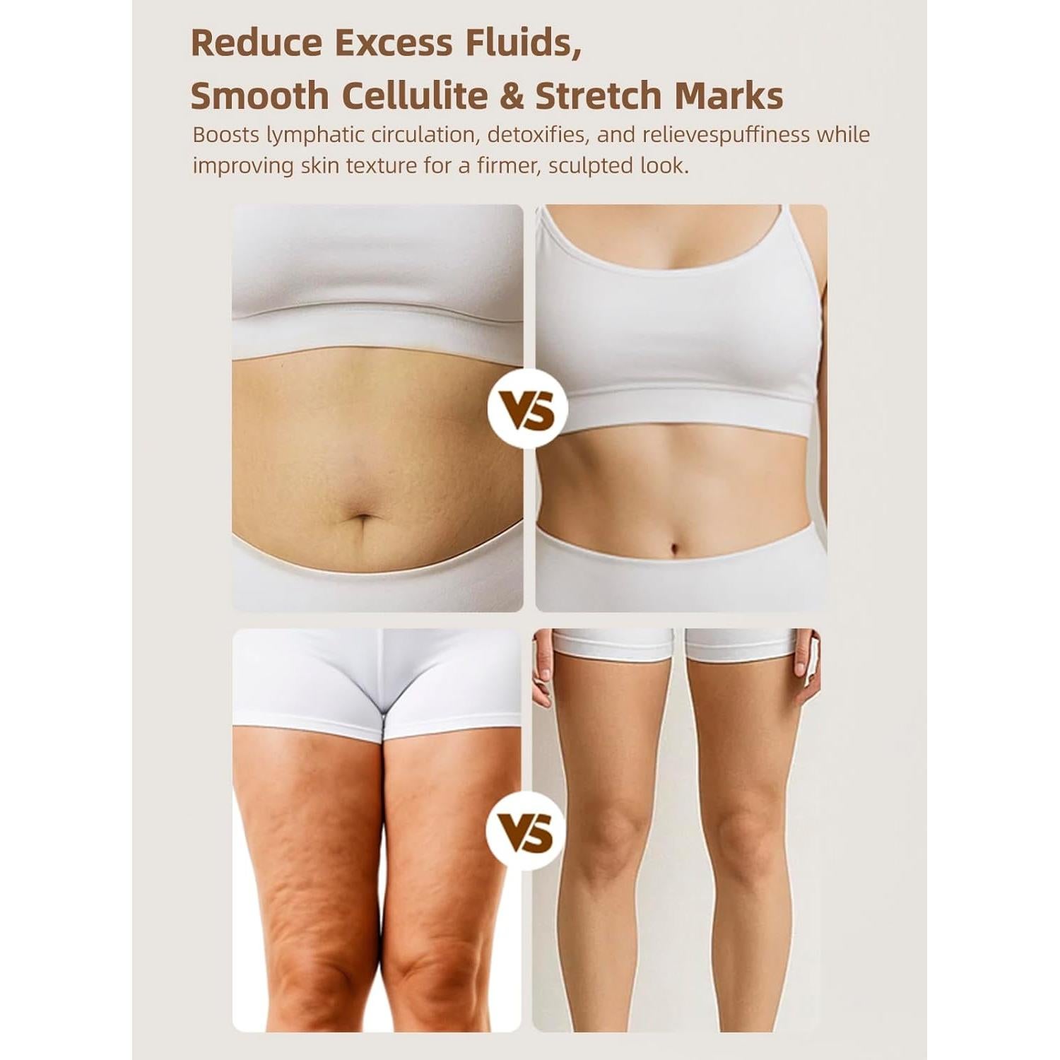 Masajeador Drenaje Linfático Yuonry L1, Anticelulitis, 9.5x9.5 cm