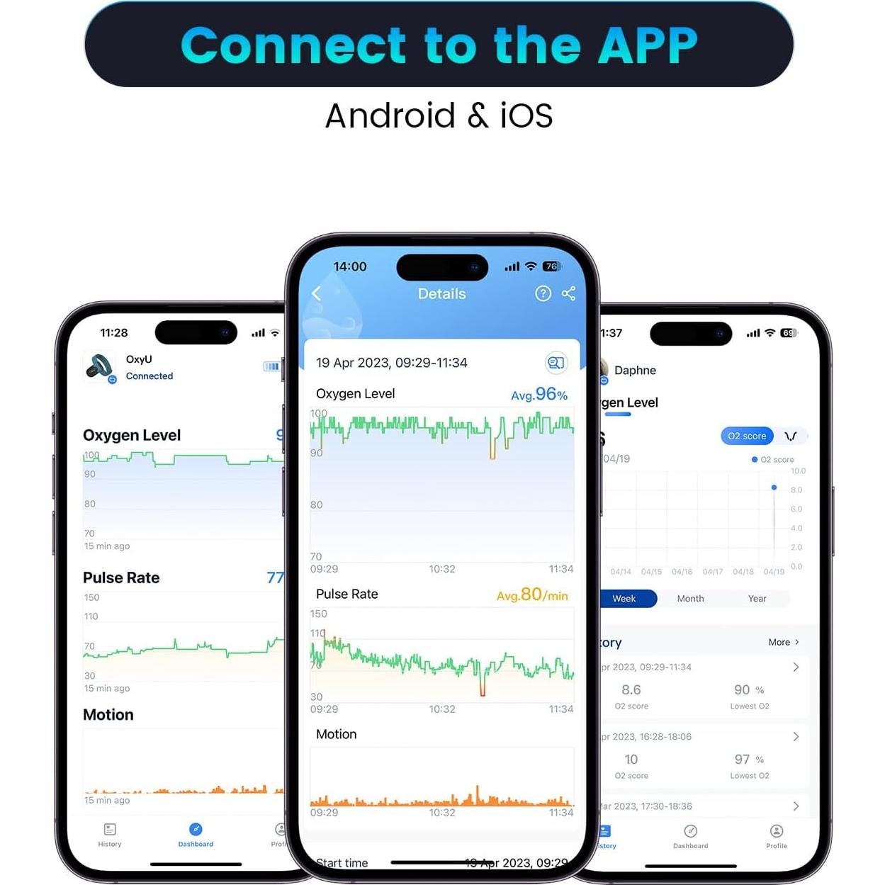 Oxímetro de Pulso Vibeat OxyU - Monitor de Oxígeno Bluetooth