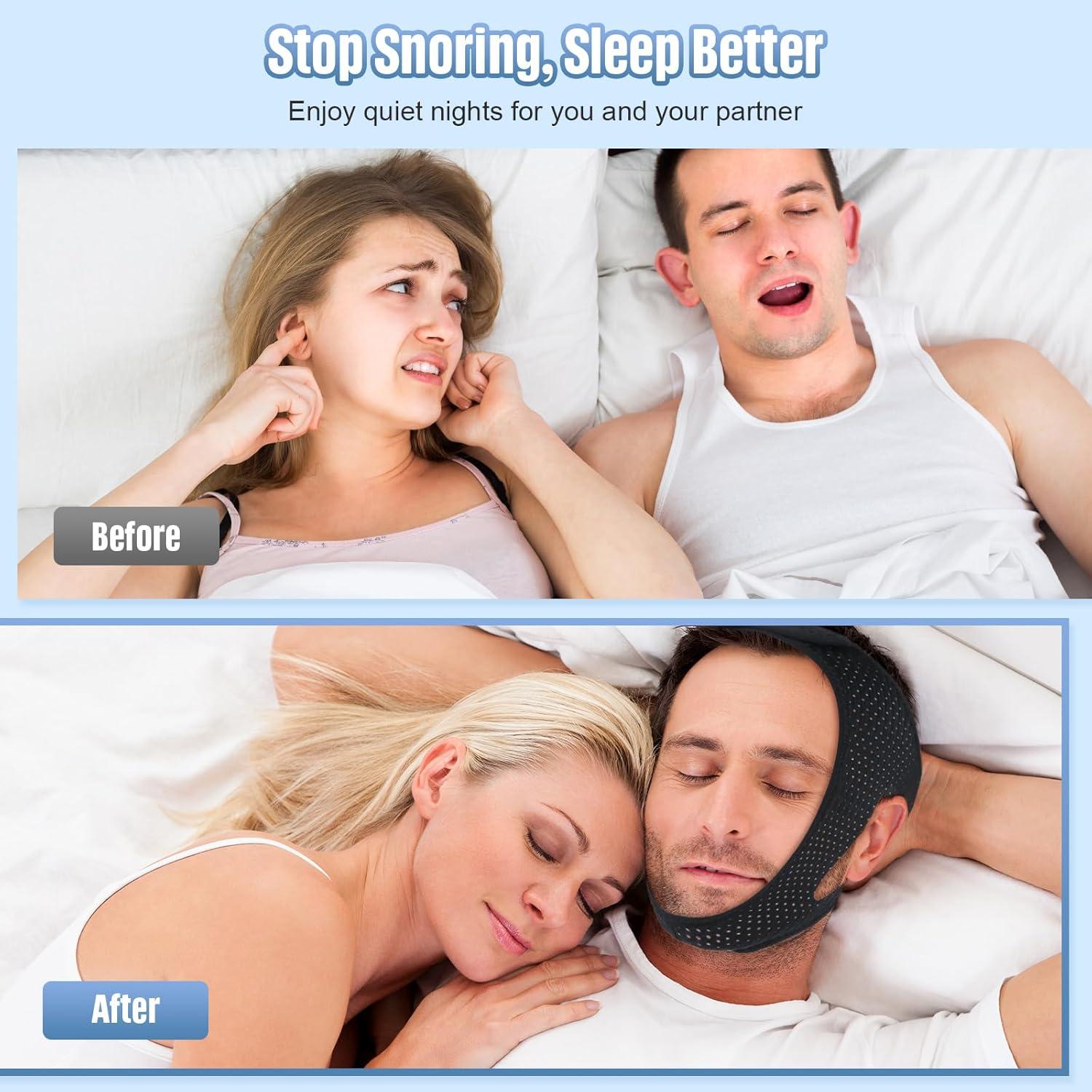 Correa Anti Ronquidos MOCCOOL Ajustable Transpirable 2 Piezas