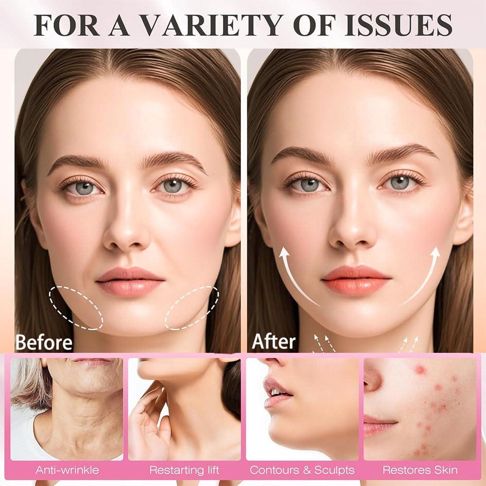 Correa Facial Anti-Ronquidos Sparkle Rise - Reutilizable y Ajustable