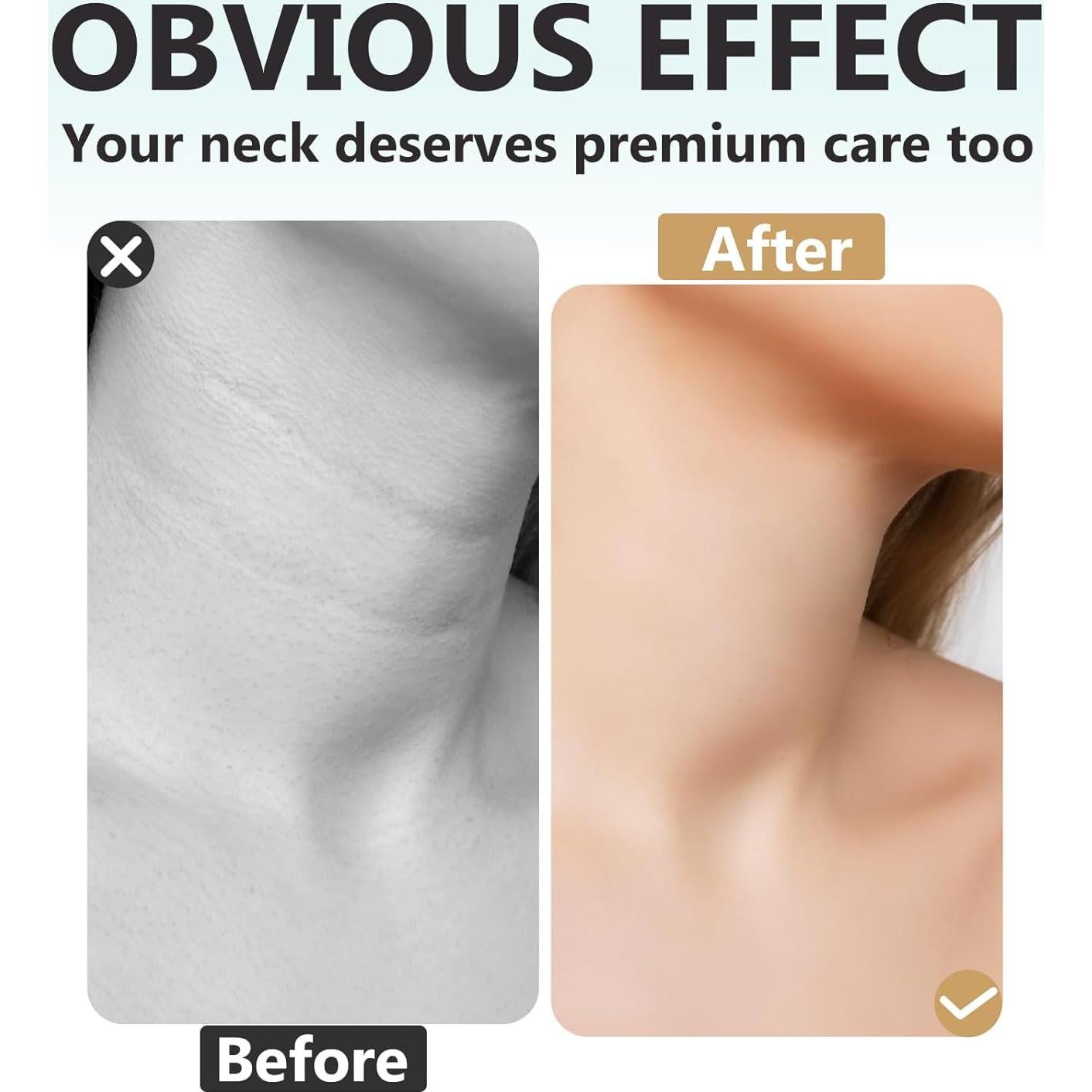 Cinta Levantadora de Cuello TANGDIAABBCC - 20 Piezas Reutilizables