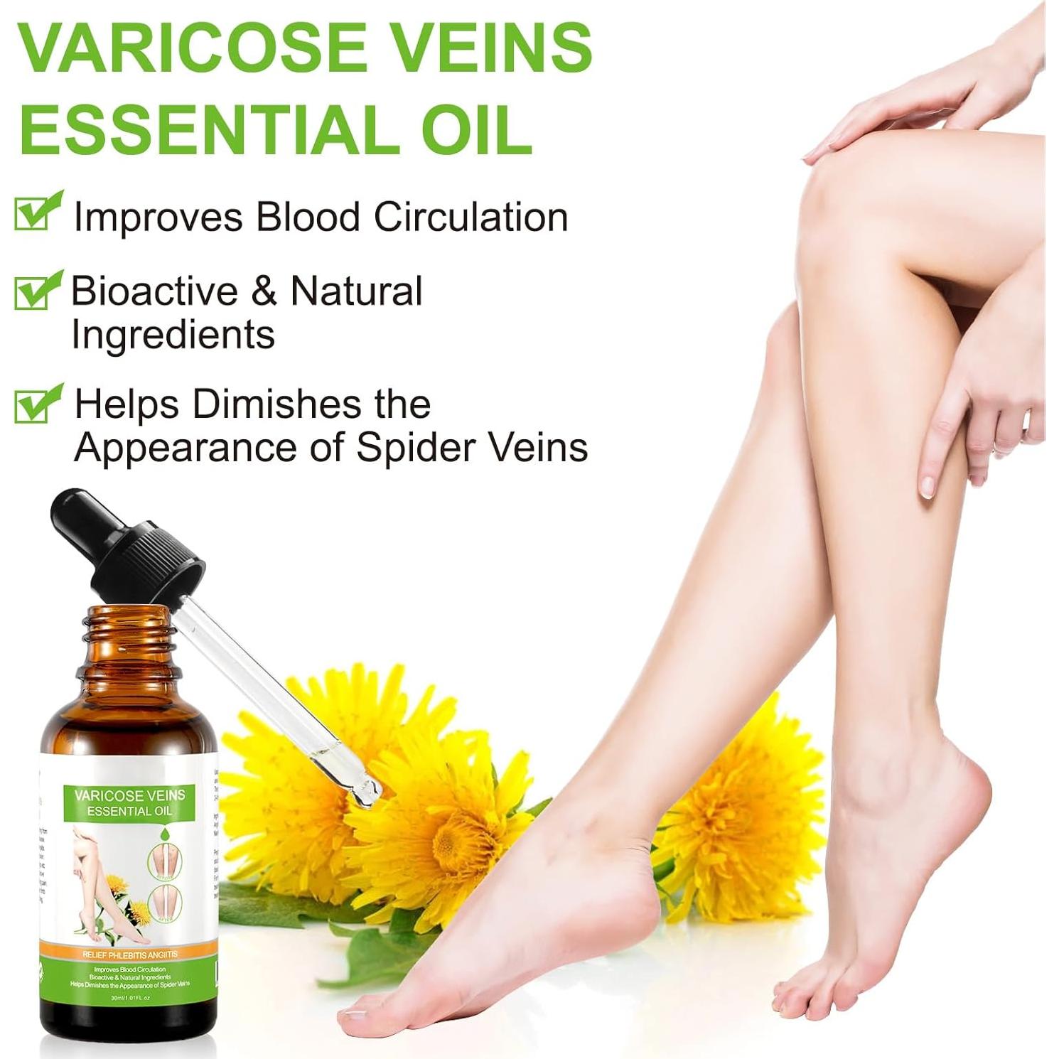 Aceite Esencial IKZEE para Venas Varicosas 30ML - Hidratante