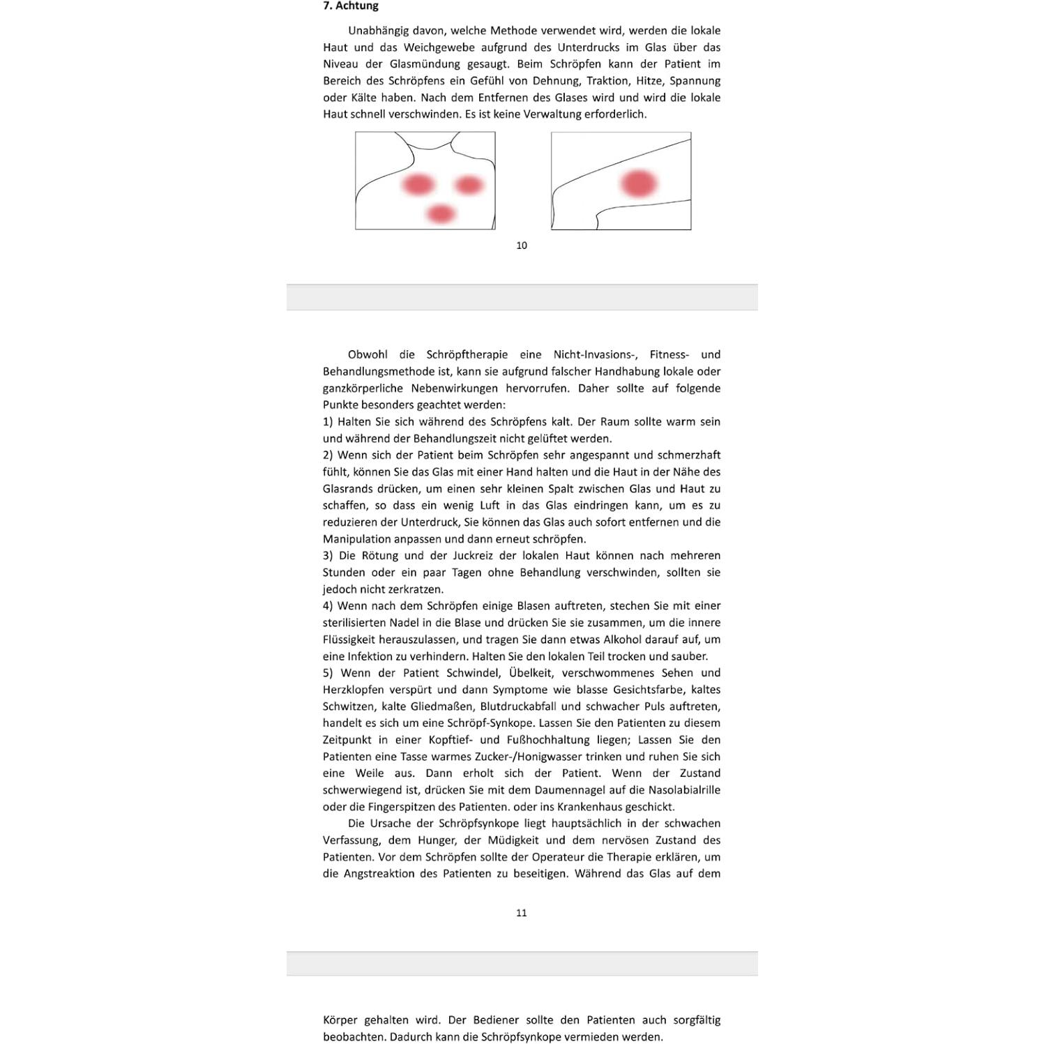 Juego de Ventosas de Silicona ELERA para Masaje y Celulitis