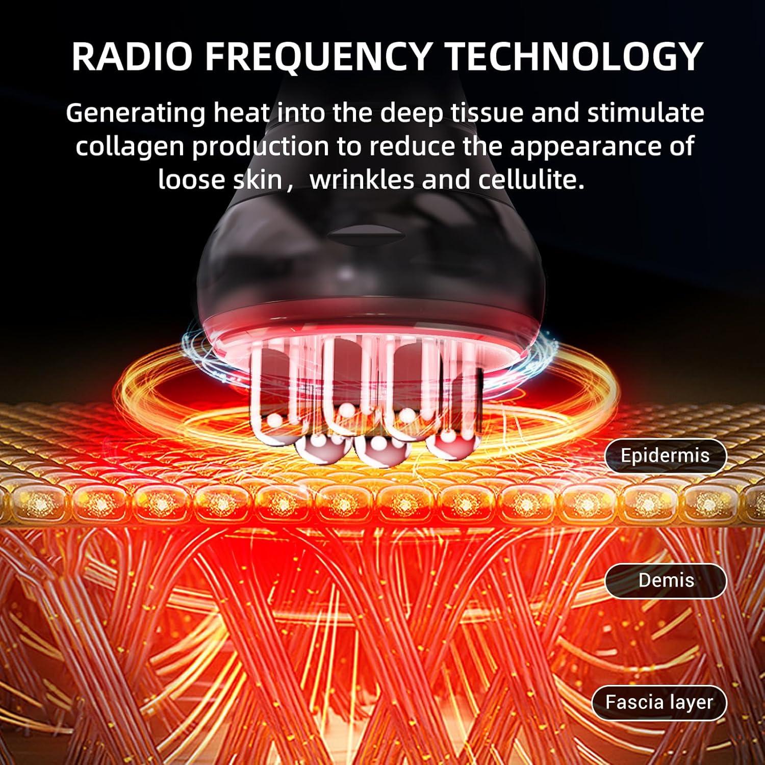 Masajeador de Celulitis SonGxu G05-0115-2 Radiofrecuencia