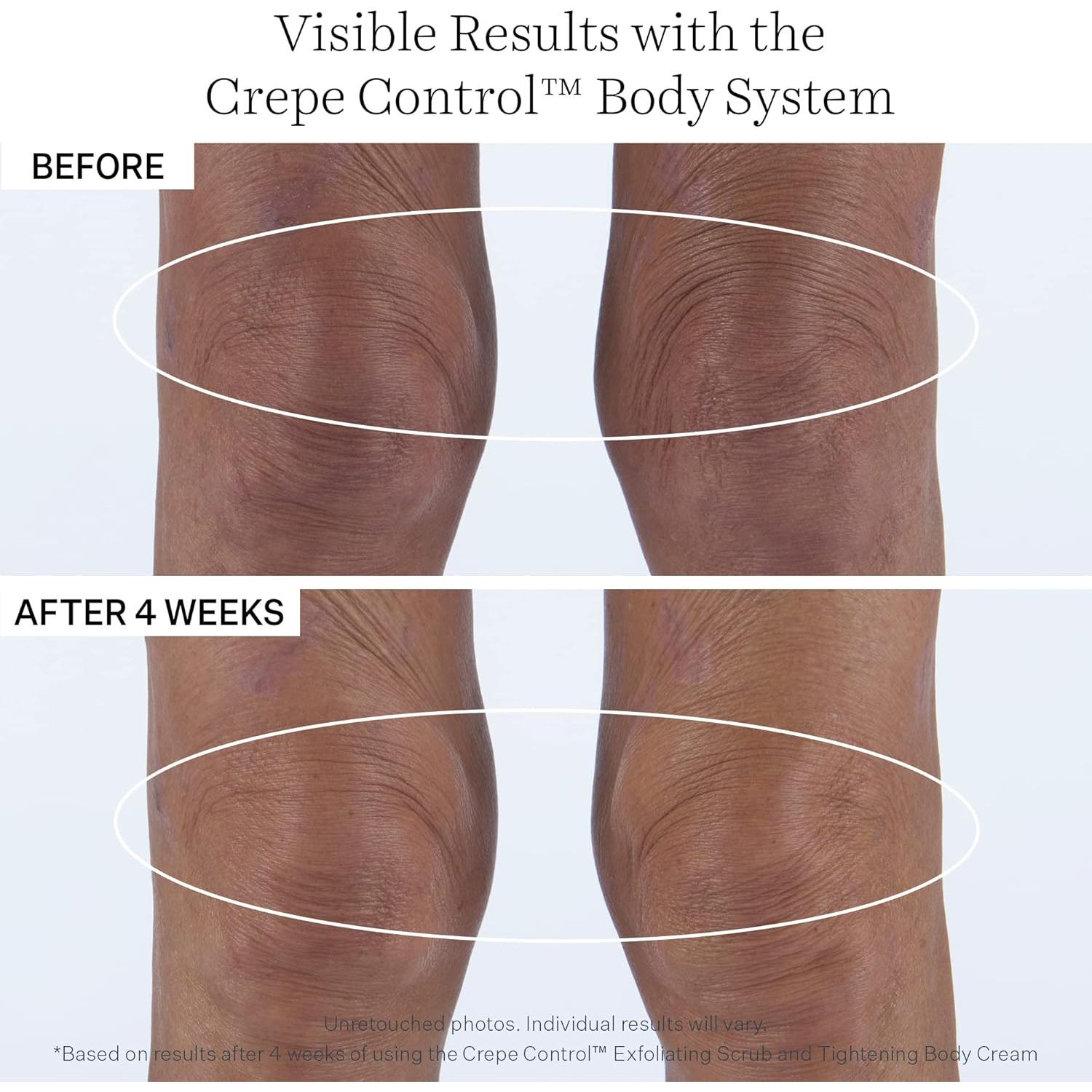 Crema Corporal Control de Crepas StriVectin 240g Hidratante