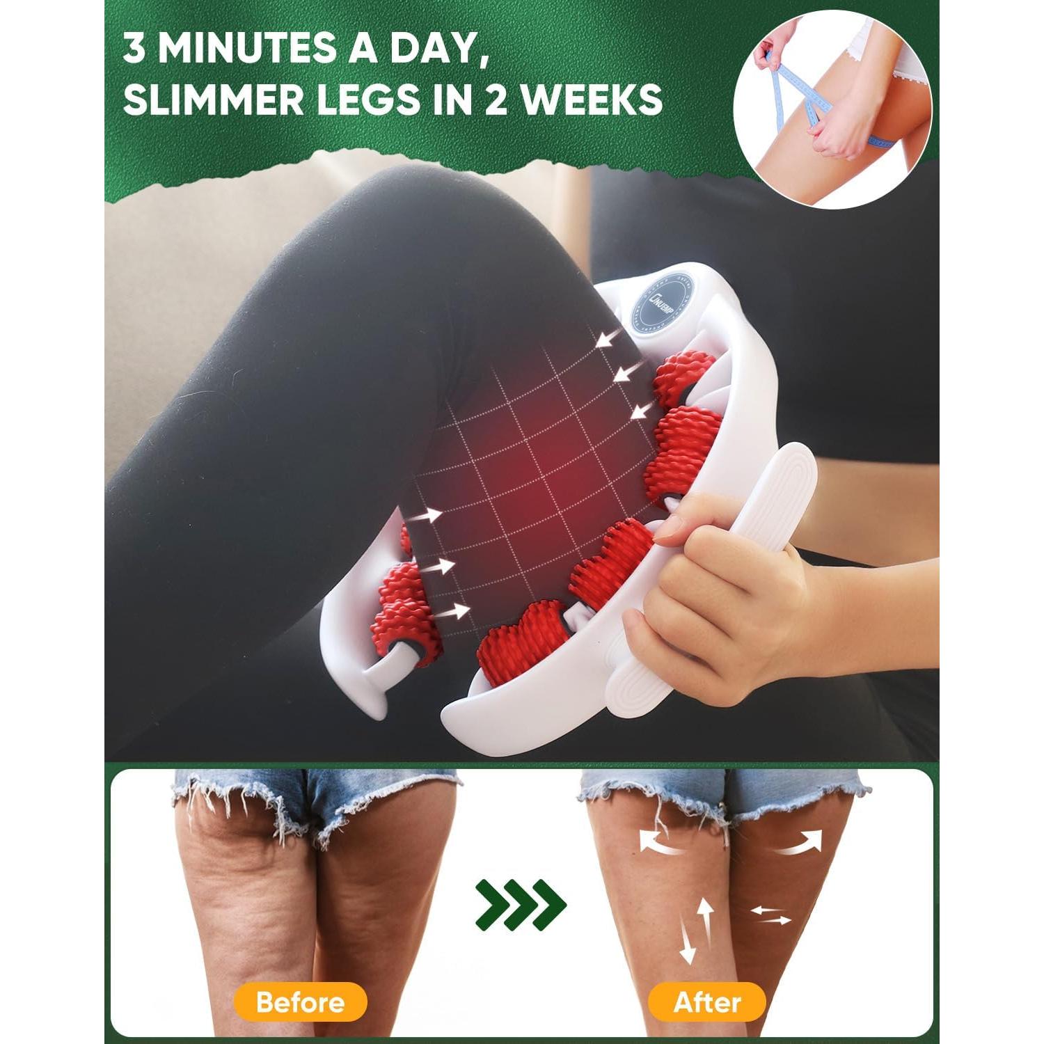 Masajeador Anti-Celulitis ONUEMP para Piernas 25.4x24.9cm