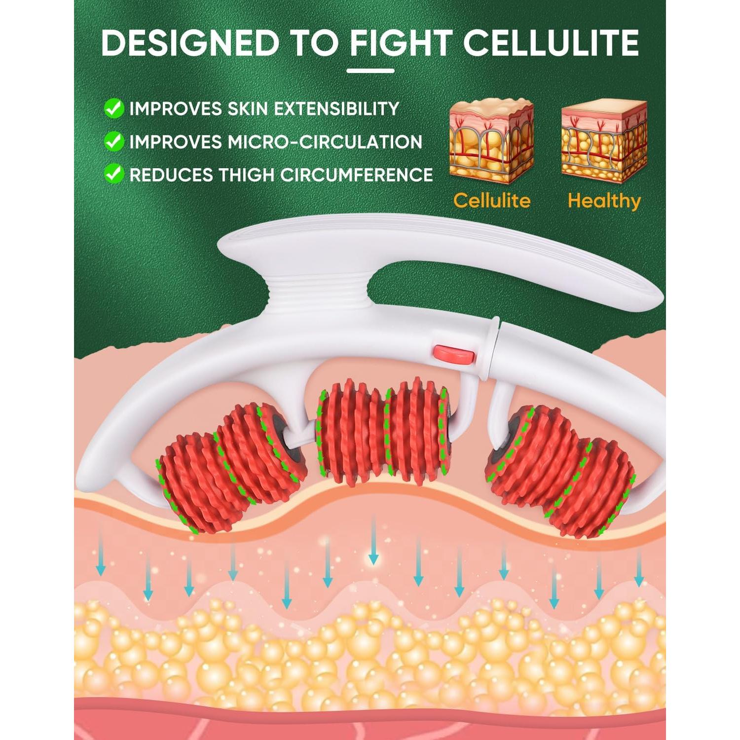 Masajeador Anti-Celulitis ONUEMP para Piernas 25.4x24.9cm