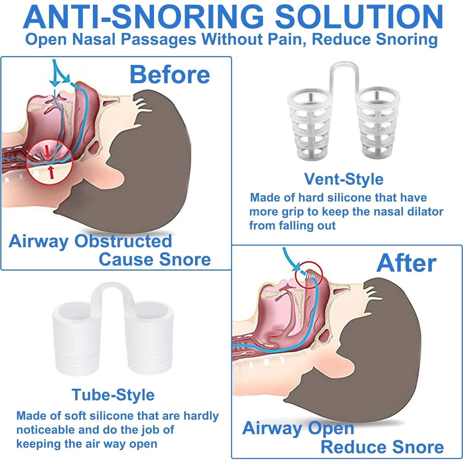 Dilatadores Nasales UyiCare para Ronquidos - 8 Clips, 4 Tamaños