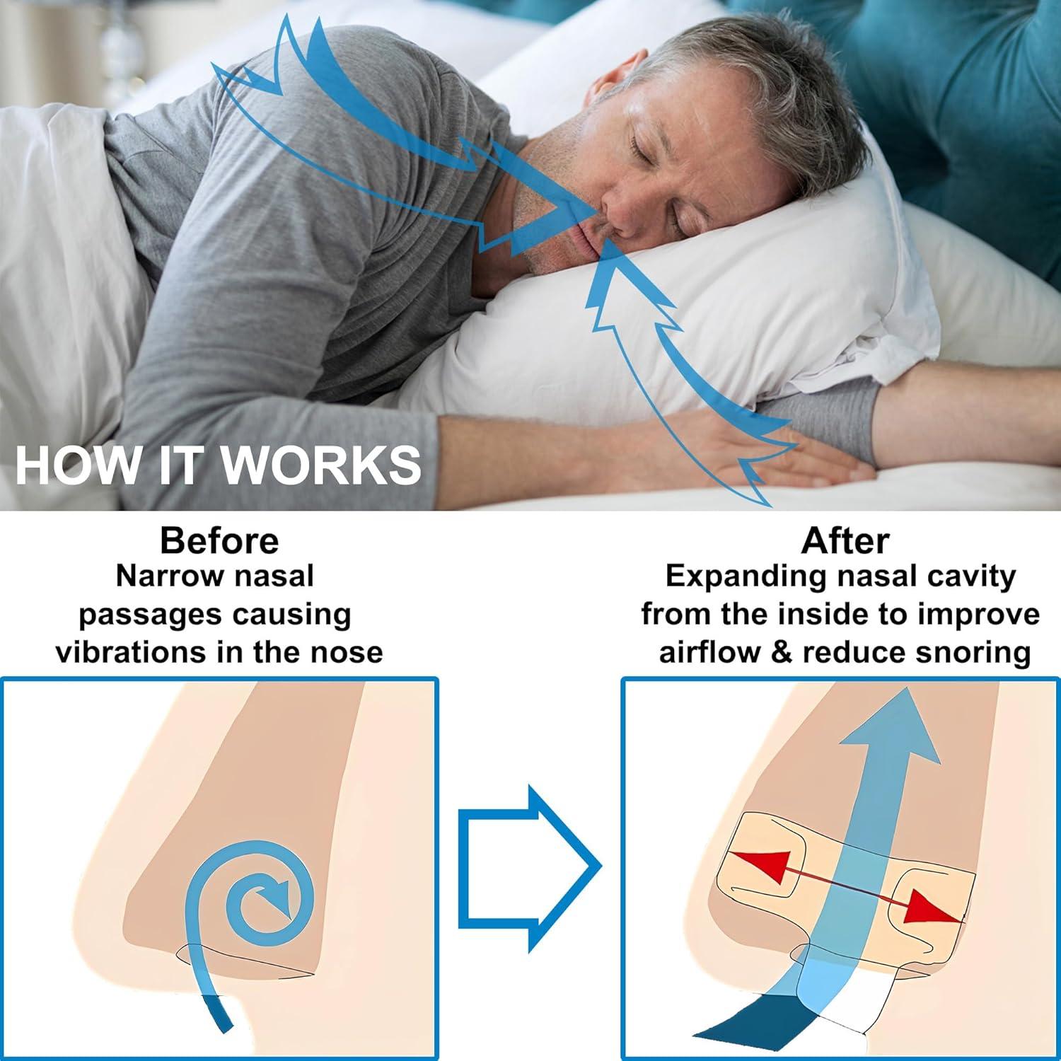 Dilatores Nasales Antirronquido UyiCare - Paquete de 4 Clips