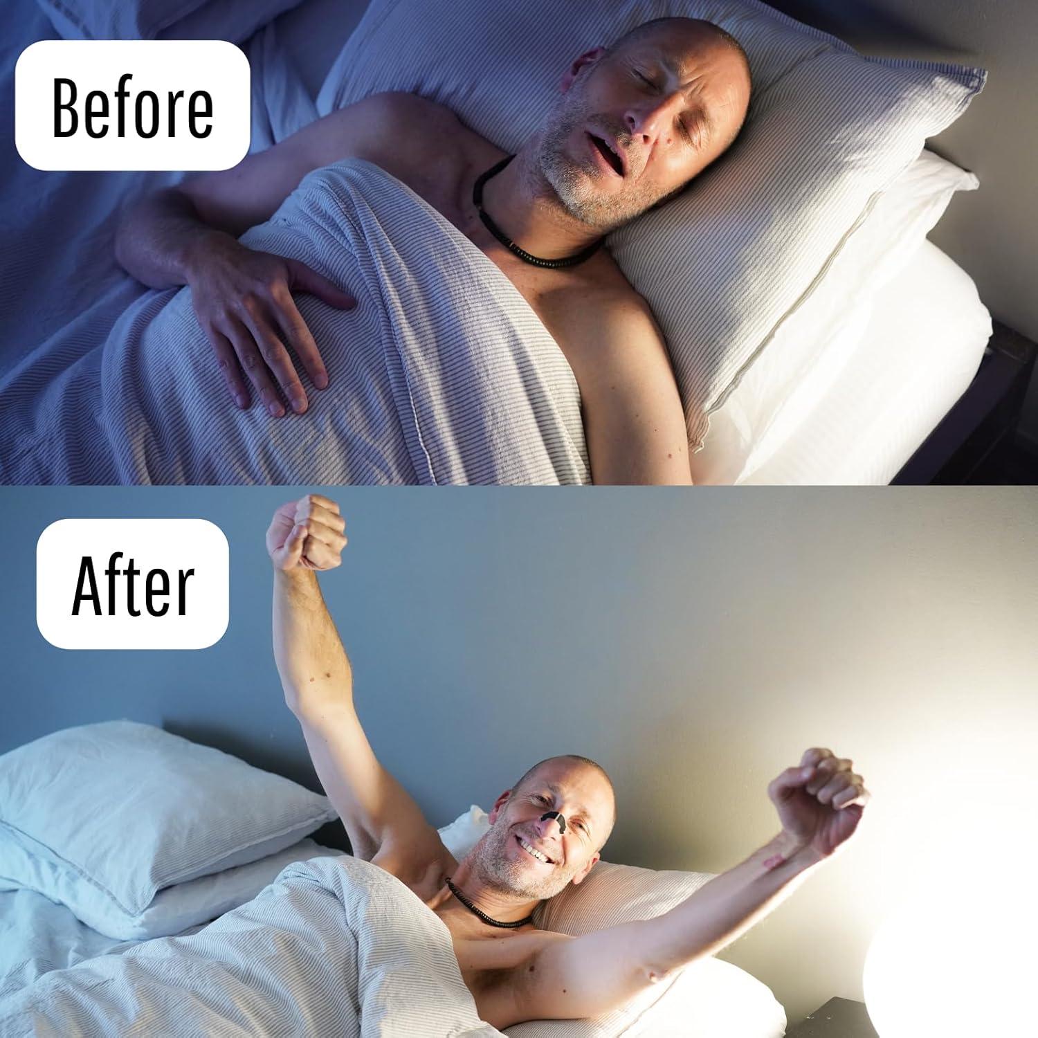 Tiras Nasales AIREVOLUTION 30 Unidades - Alivio Ronquidos