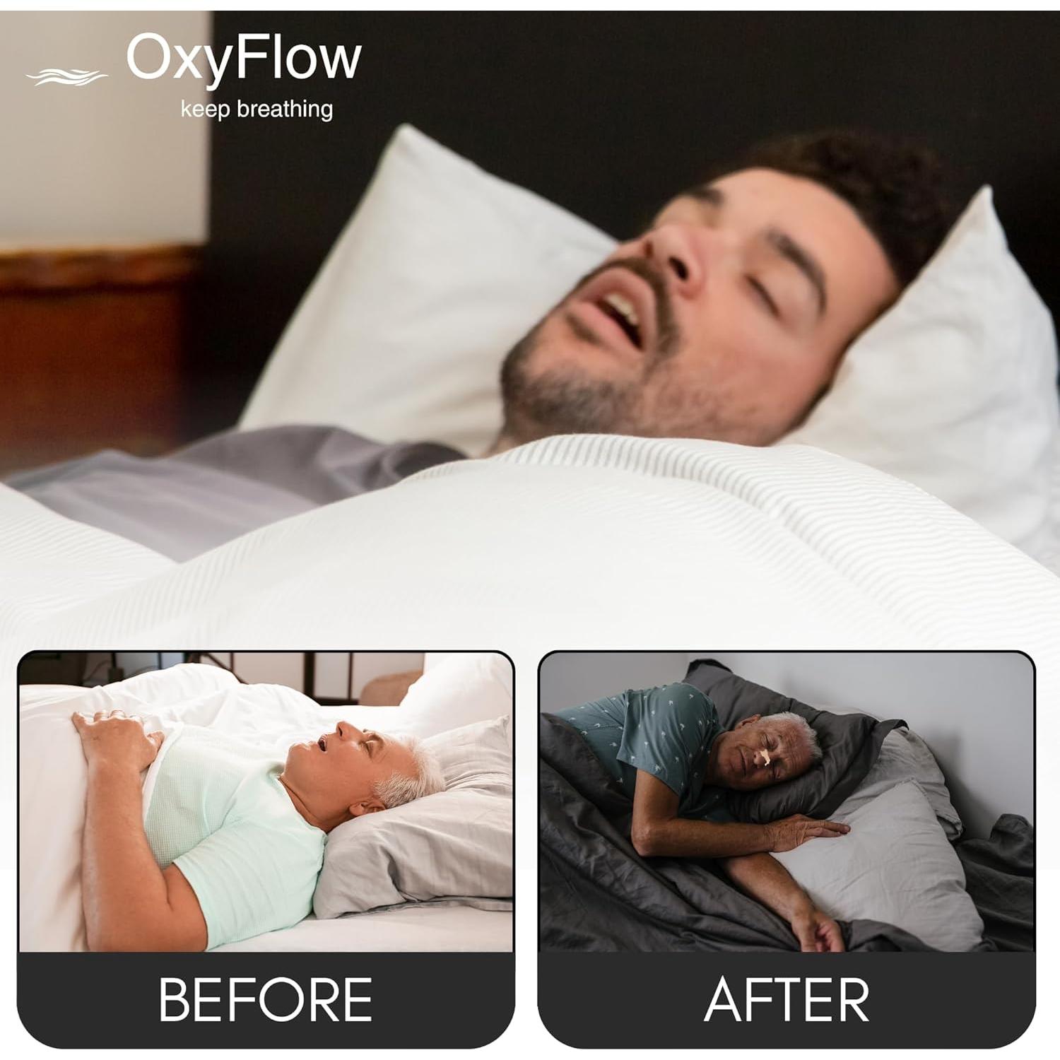 Tiras Nasales OxyFlow Modelo Y - 30 Unidades para Alivio Nasal