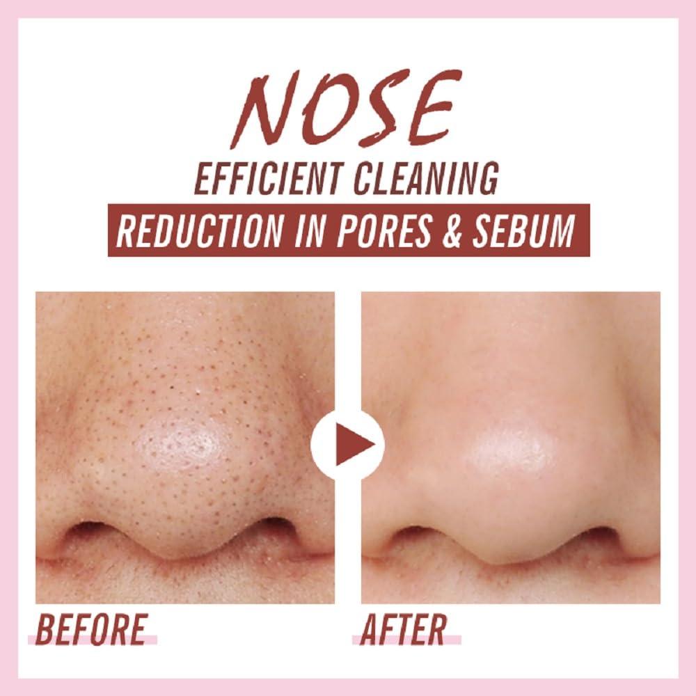 Tiras Nasales Caunmy para Puntos Negros - 20 PCS