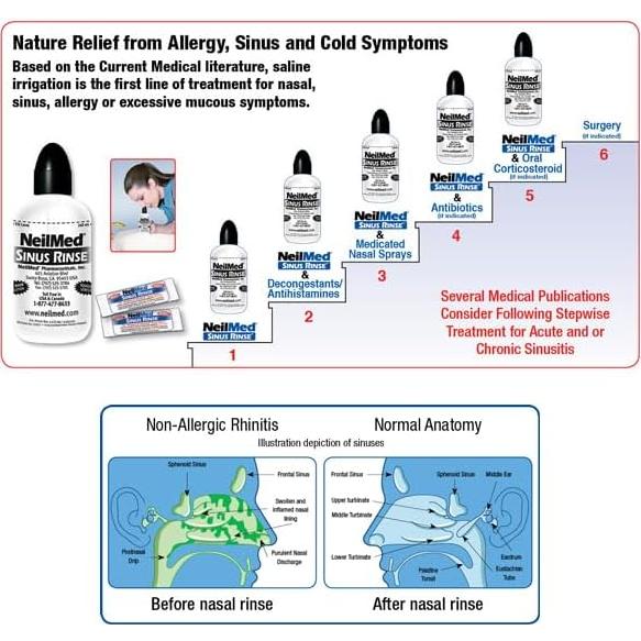 Kit de Lavado Nasal NeilMed - 50 Unidades, Terapéutico
