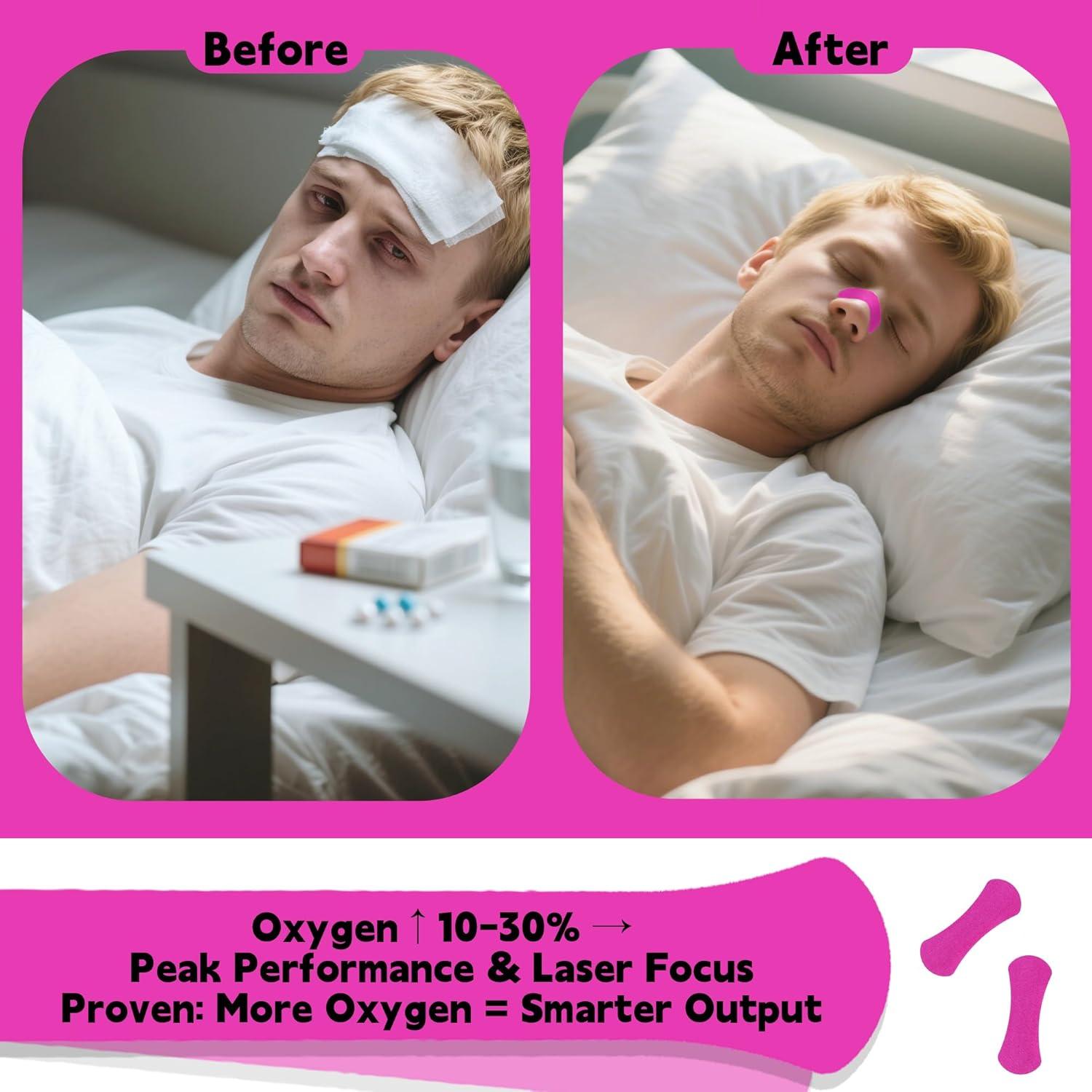 Tiras Nasales Nepia 50 Pack - Sin Láttex, Rosa Rojo