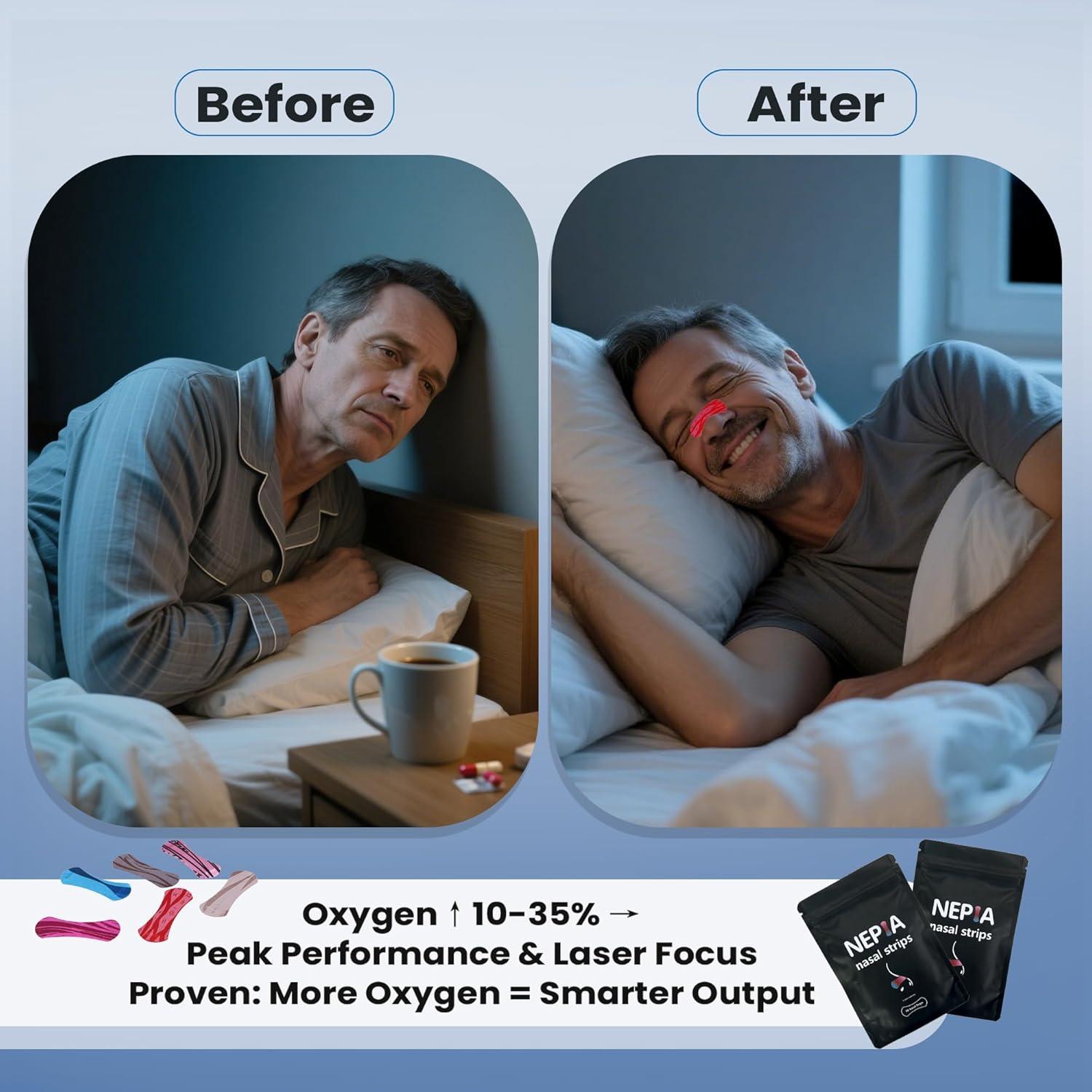 Tiras Nasales Hipoalergénicas Nepia - 30 Unidades para Respirar Mejor