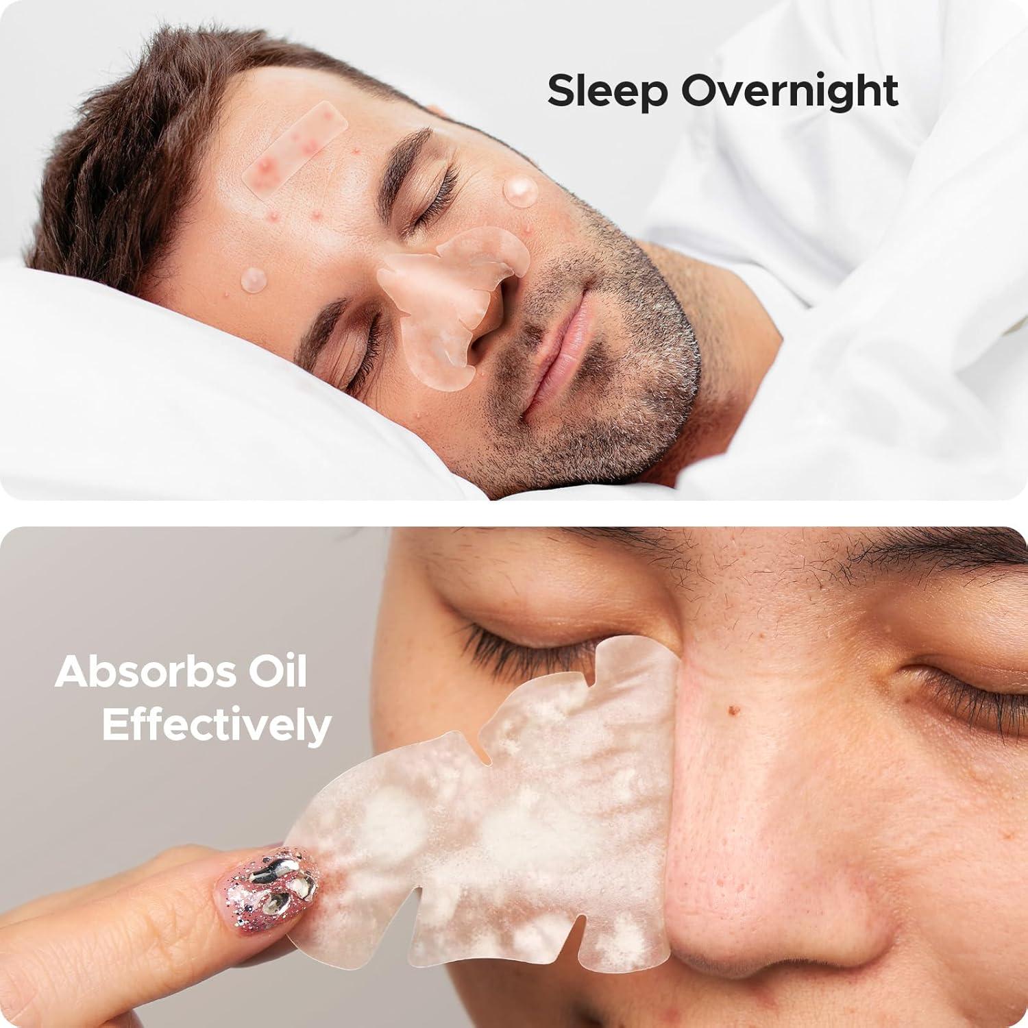 Parches Hidrocoloides para Nariz TKTK - 112 Piezas XL 91x48mm