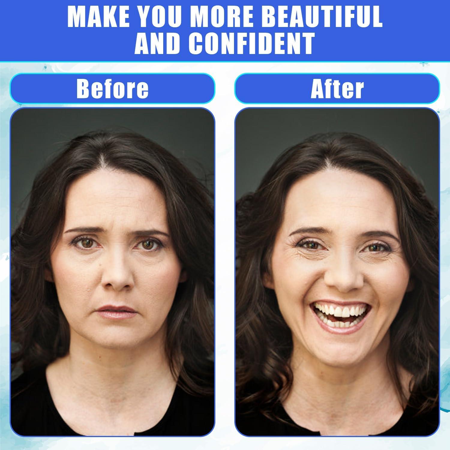 3 Piezas Ejercitador de Mandíbula NQEUEPN Silicona 6x5.5cm