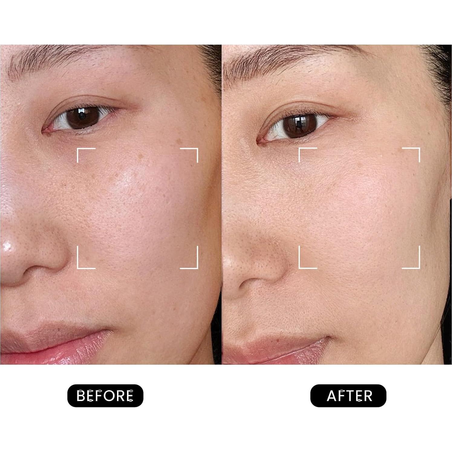 Dispositivo Facial Antienvejecimiento DermRays Revive 1064nm