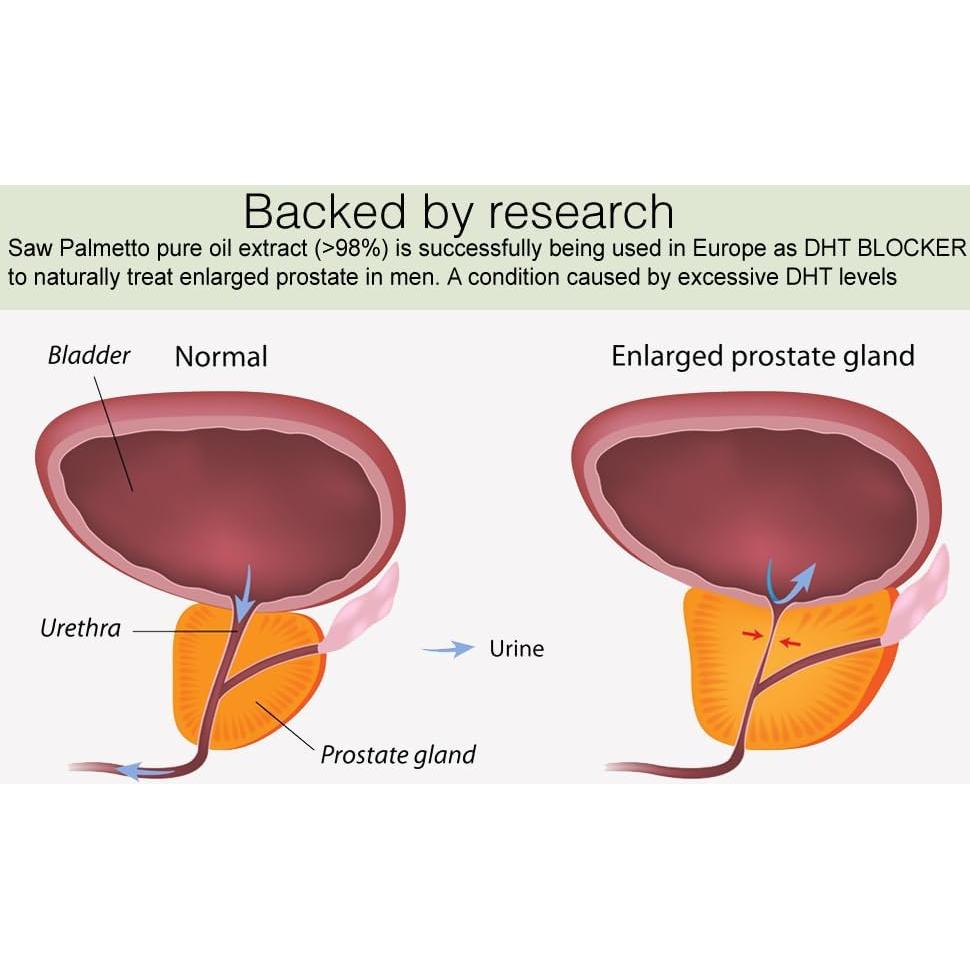 Aceite de Palma Enana Pura Orgánico 30.42 ml - Apoyo Prostático