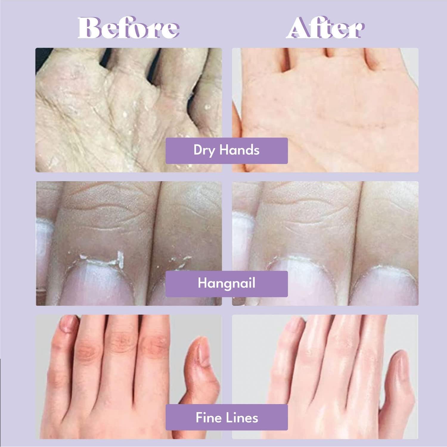 Guantes Hidratantes Toi:L 5 Pares - Cuidado de Manos Secas