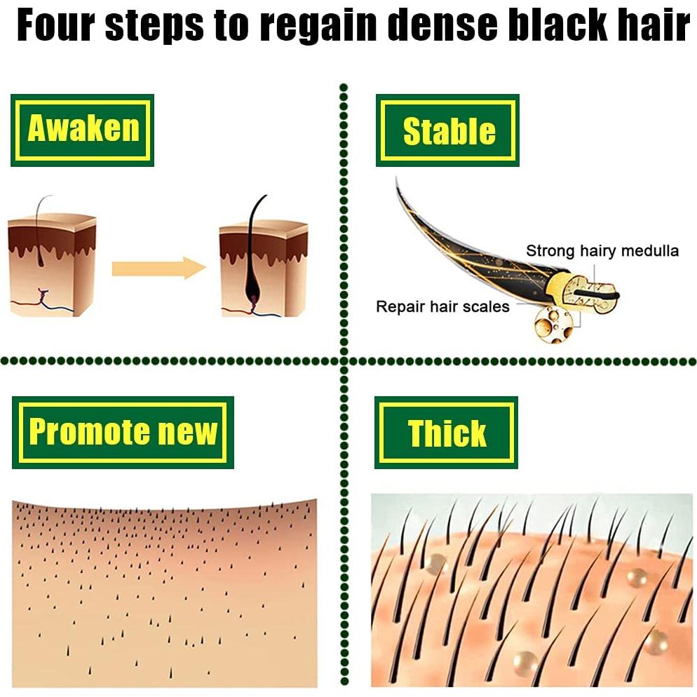 Aceite Germinal de Crecimiento Capilar Jengibre 30ml