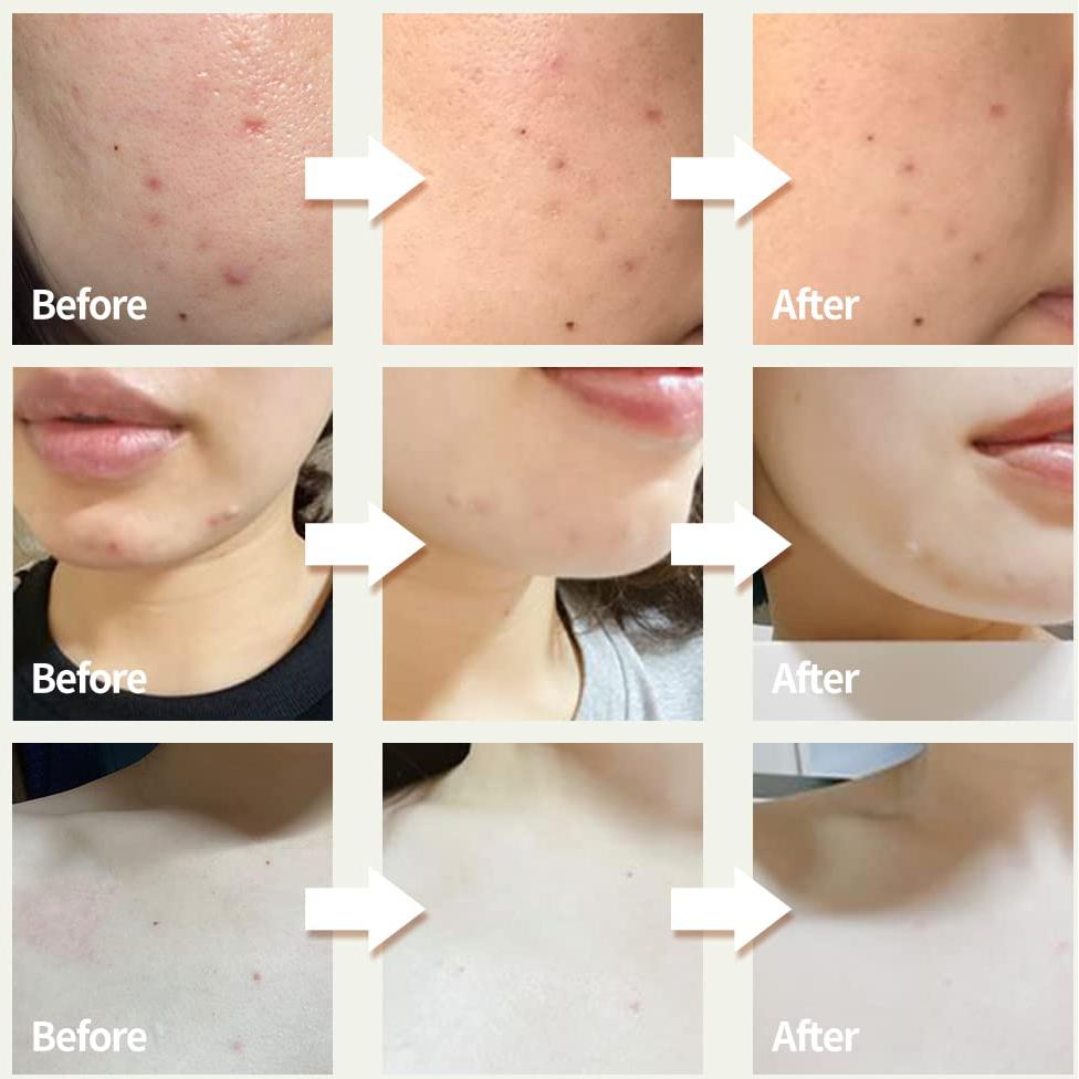 Crema Hidratante Ato Barrera de Piel 20ml - Centella Asiática