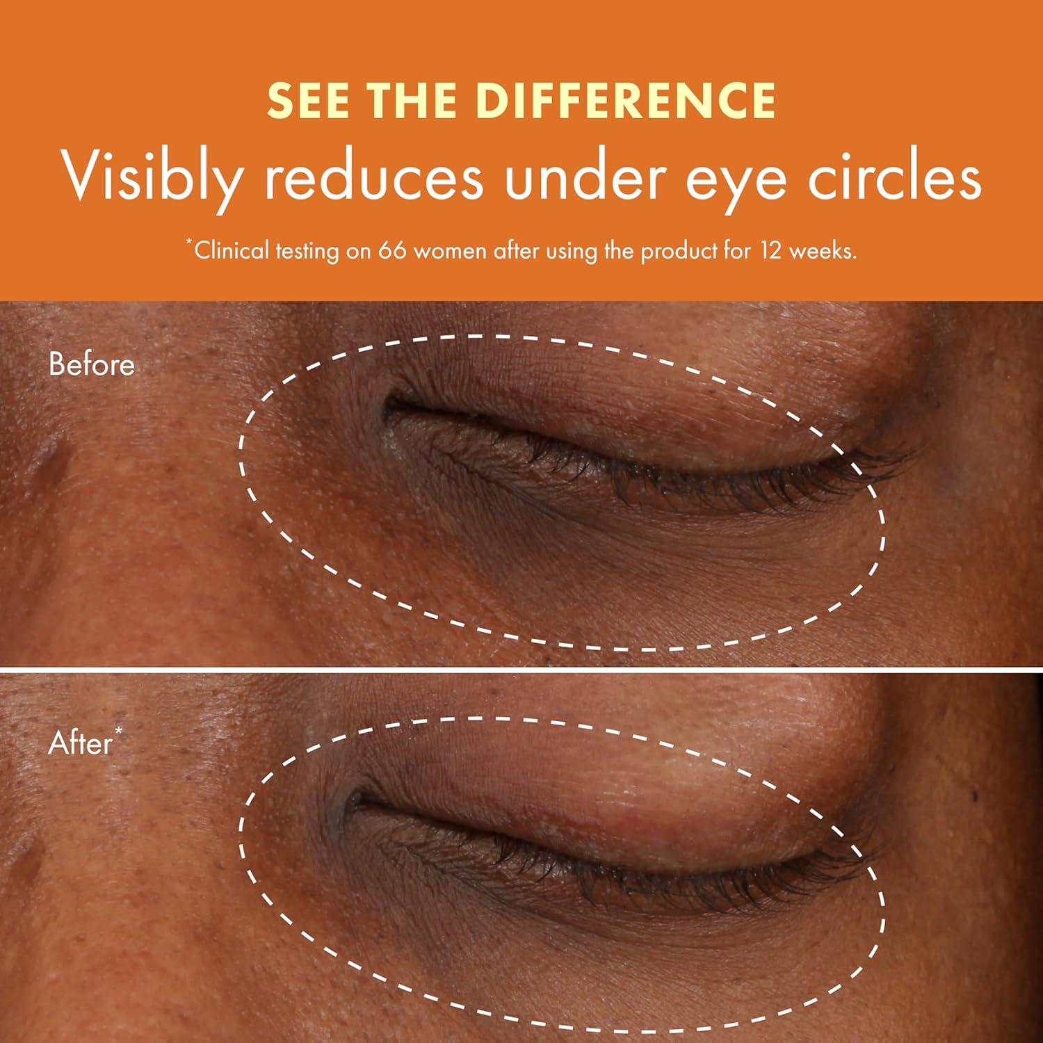 Crema para Ojos Origins GinZing 36g - Iluminadora y Anti-Ojeras