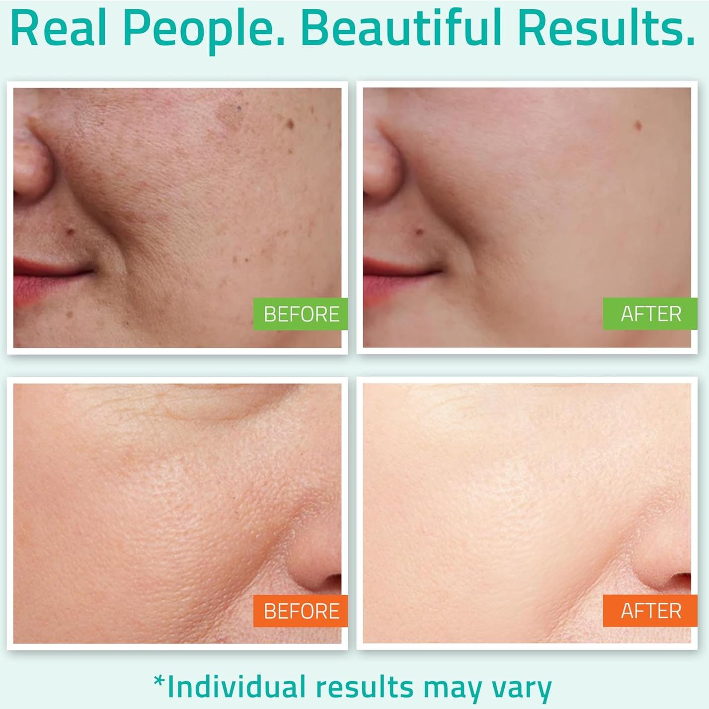 Kit de Cuidado de la Piel YEOUTH 3 Piezas: Suero, Tónico y Crema