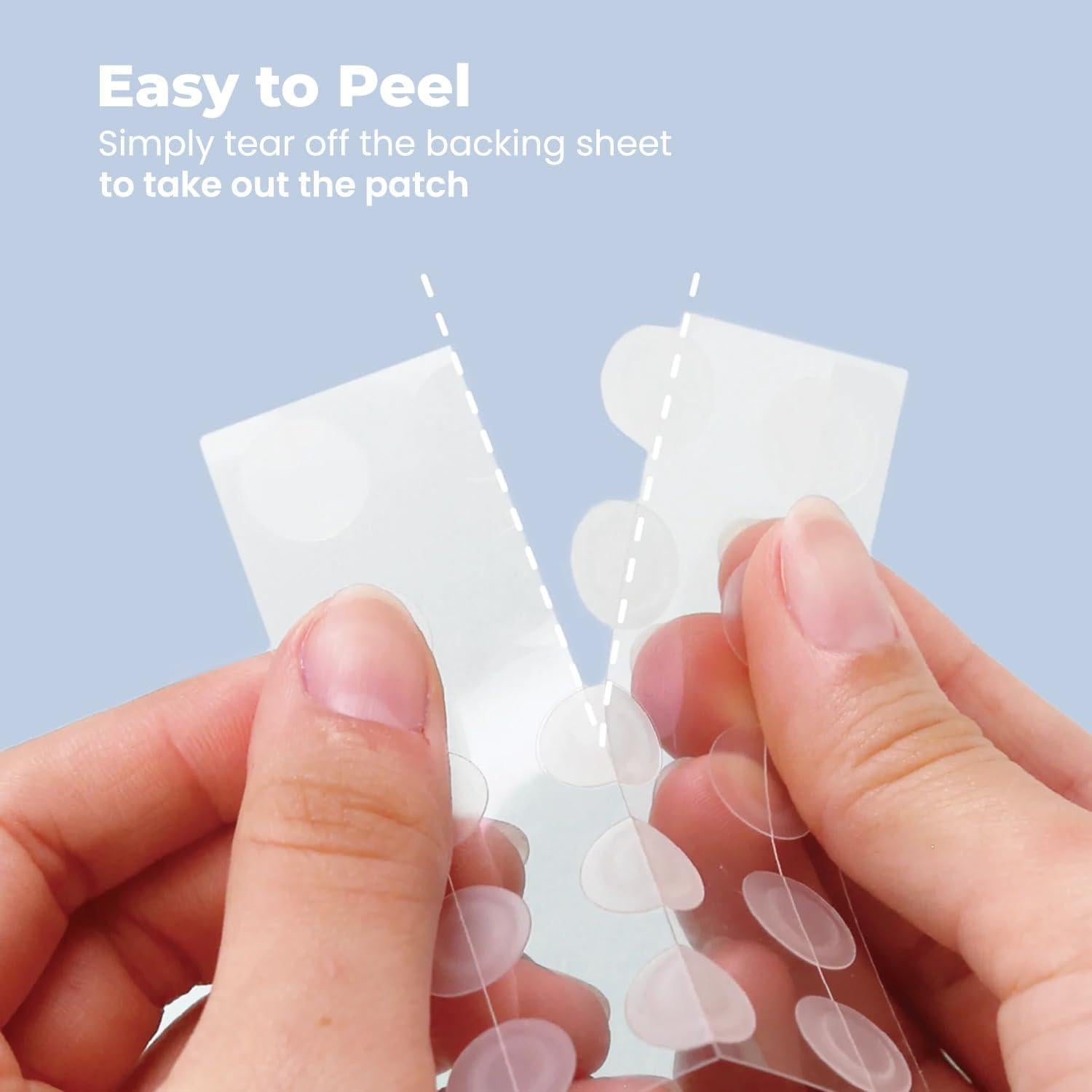 Parches Hidrocoloides RoselynBoutique para Granitos - 150 Unidades