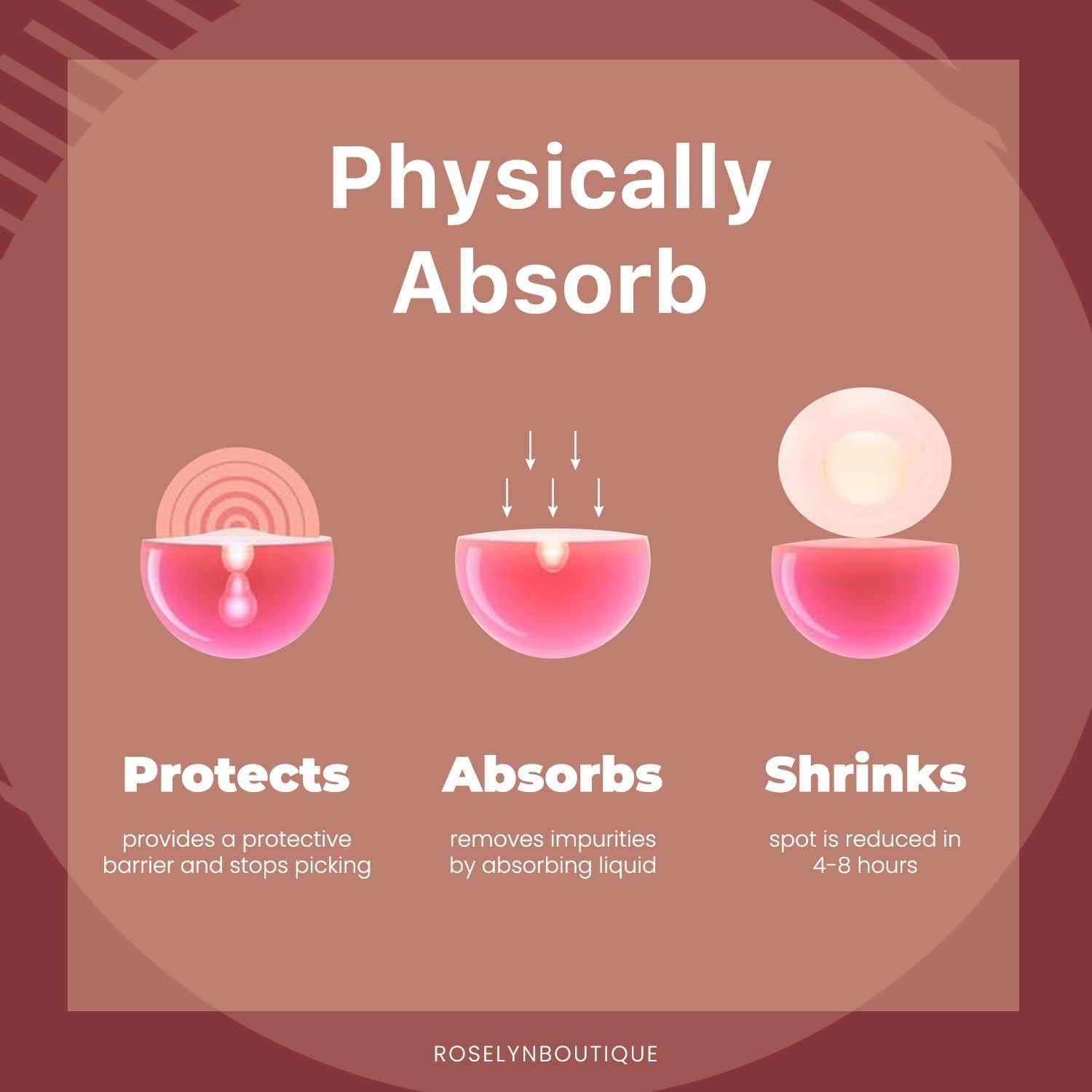 Parches Hidrocoloides RoselynBoutique para Granitos - 150 Unidades