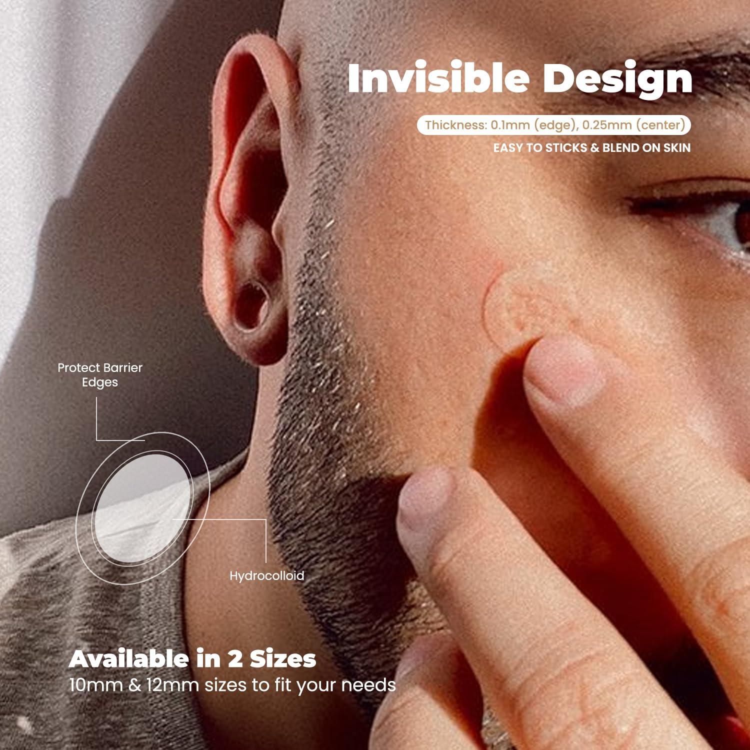 Parches Hidrocoloides RoselynBoutique para Granitos - 30 Unidades